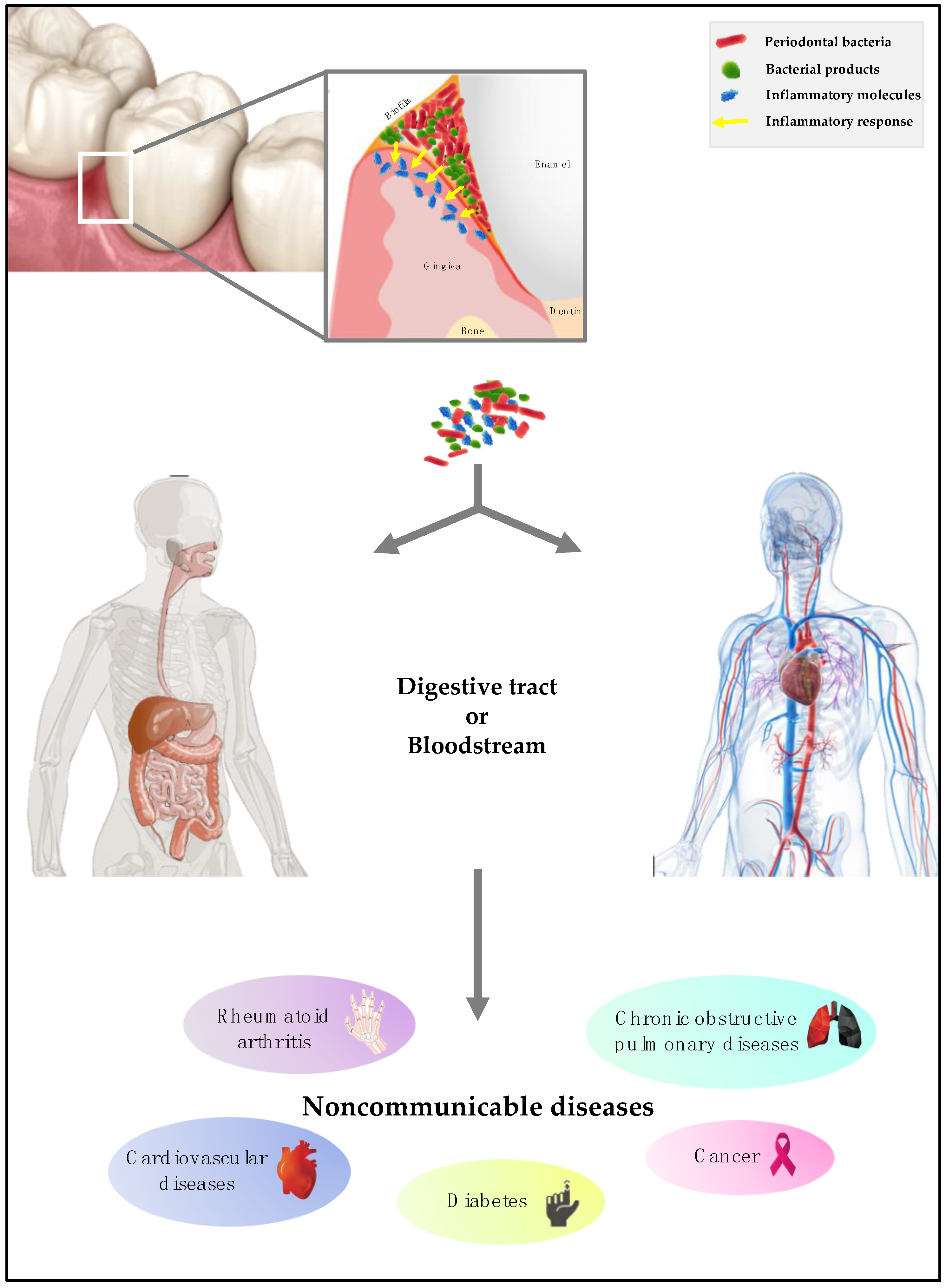 Microorganisms | Free Full-Text | Periodontal Pathogens as Risk Factors of  Cardiovascular Diseases, Diabetes, Rheumatoid Arthritis, Cancer, and  Chronic Obstructive Pulmonary Disease—Is There Cause for Consideration?