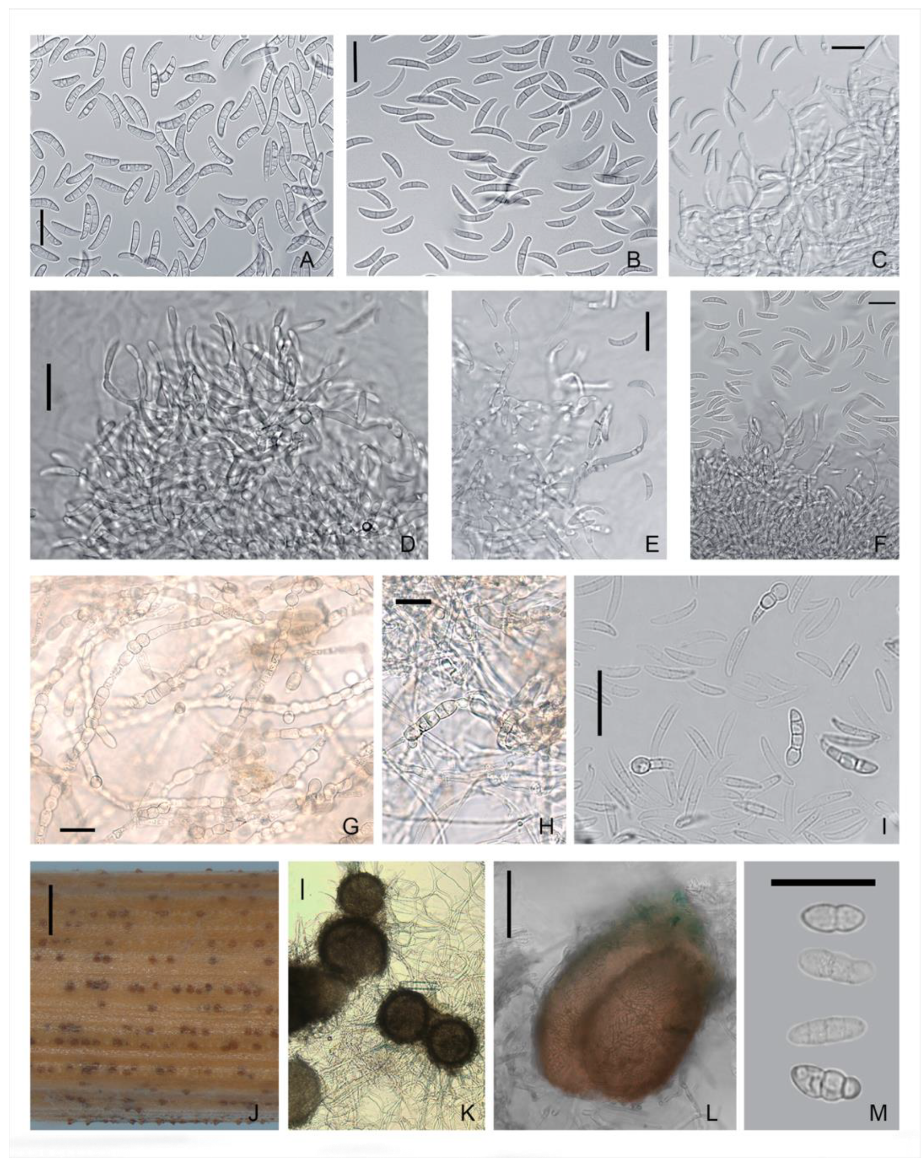 Microorganisms Free Full Text Evidence Of Microdochium Fungi Associated With Cereal Grains In Russia Html