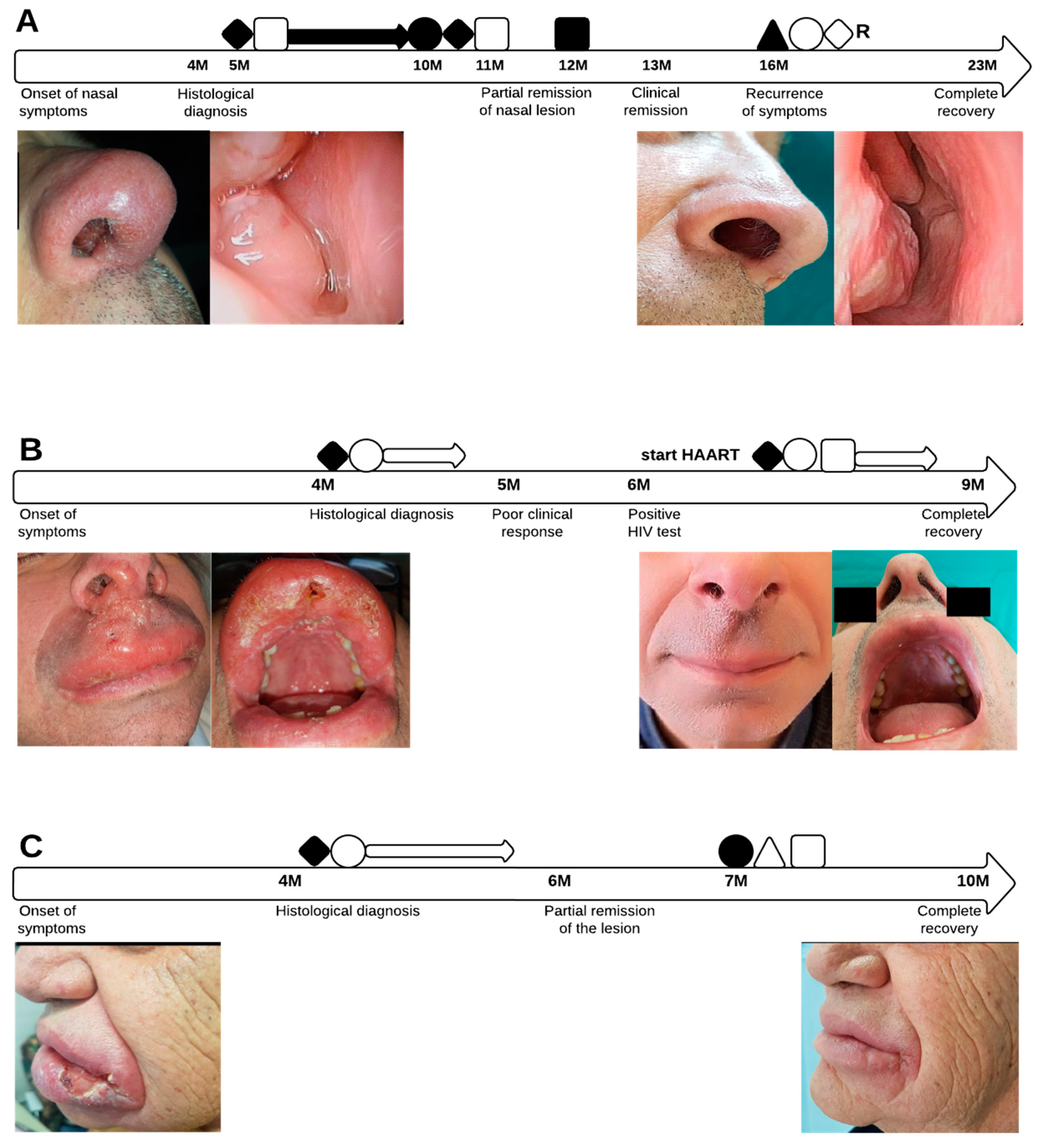 Microorganisms | Free Full-Text | Autochthonous Cases of Mucosal