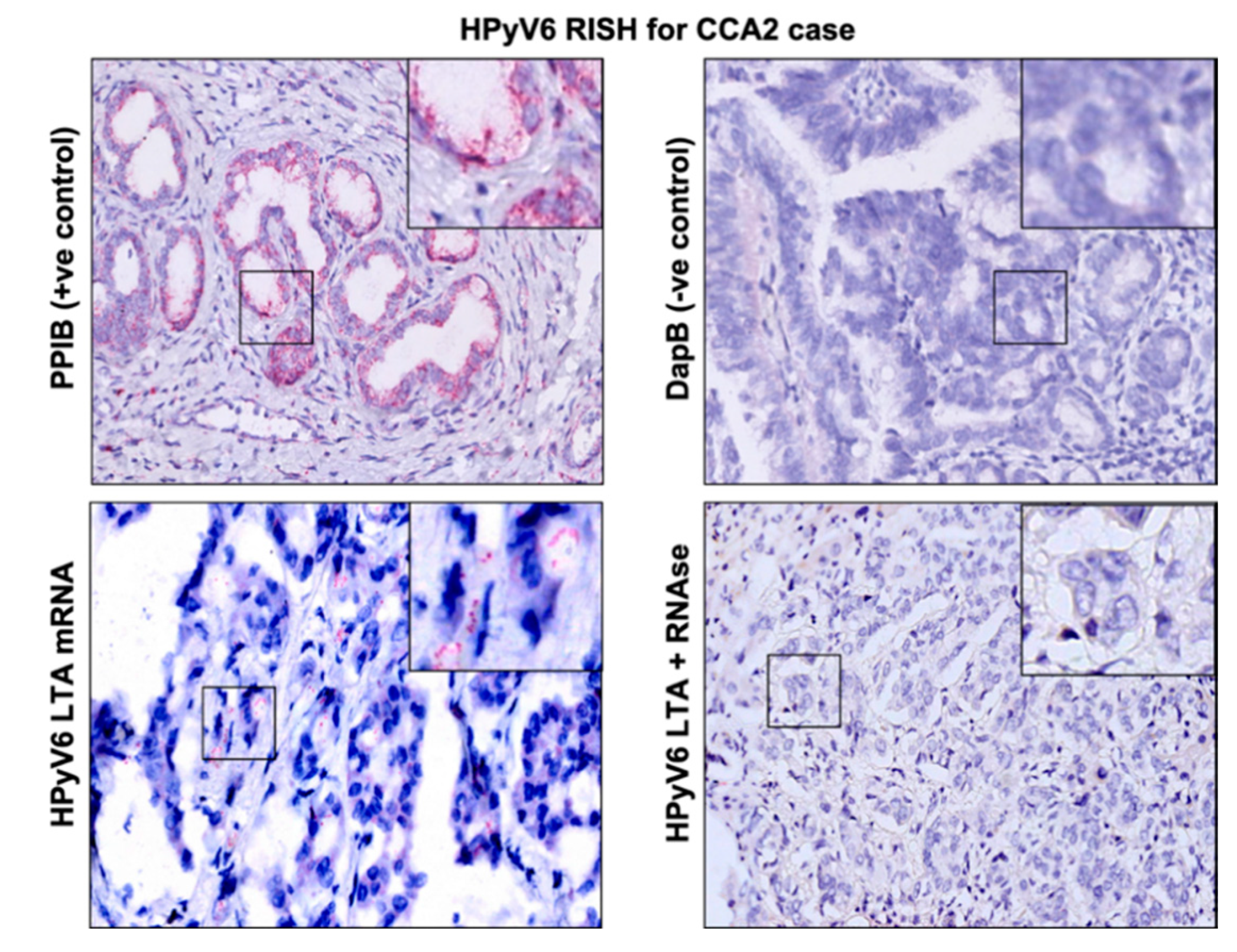 Microorganisms 08 01125 g003