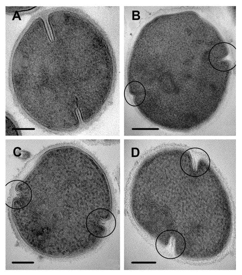 https://www.mdpi.com/microorganisms/microorganisms-08-01991/article_deploy/html/images/microorganisms-08-01991-g009-550.jpg