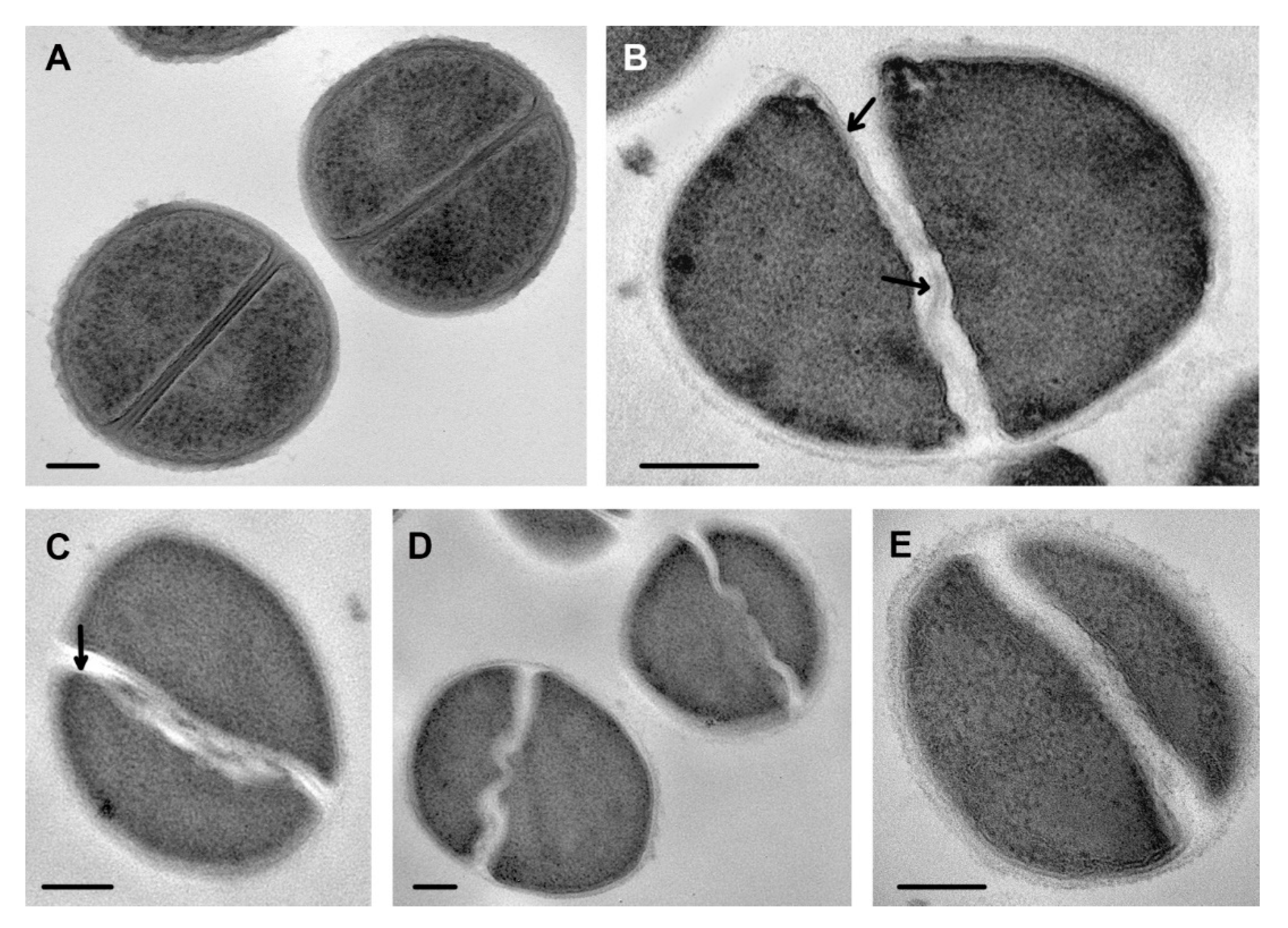 Staphylococcus aureus under microscope: microscopy of Gram