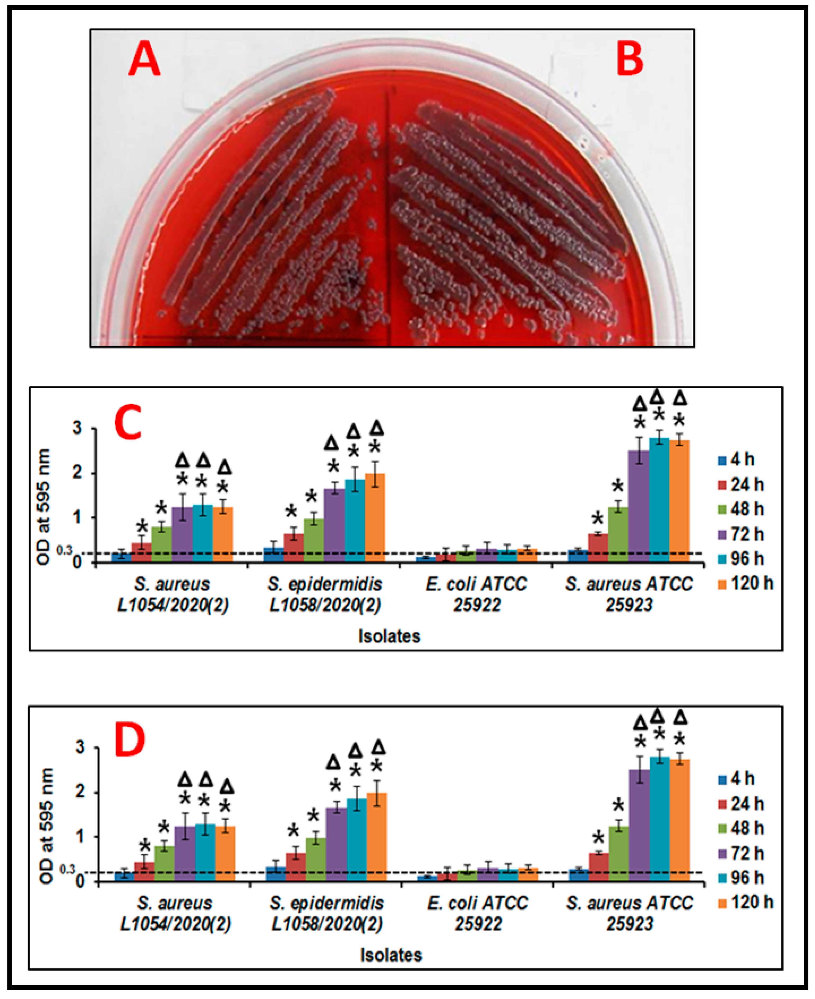 Napier knoglebrud Der er en tendens Microorganisms | Free Full-Text | Biofilm-Forming Potential of Ocular Fluid  Staphylococcus aureus and Staphylococcus epidermidis on Ex Vivo Human  Corneas from Attachment to Dispersal Phase