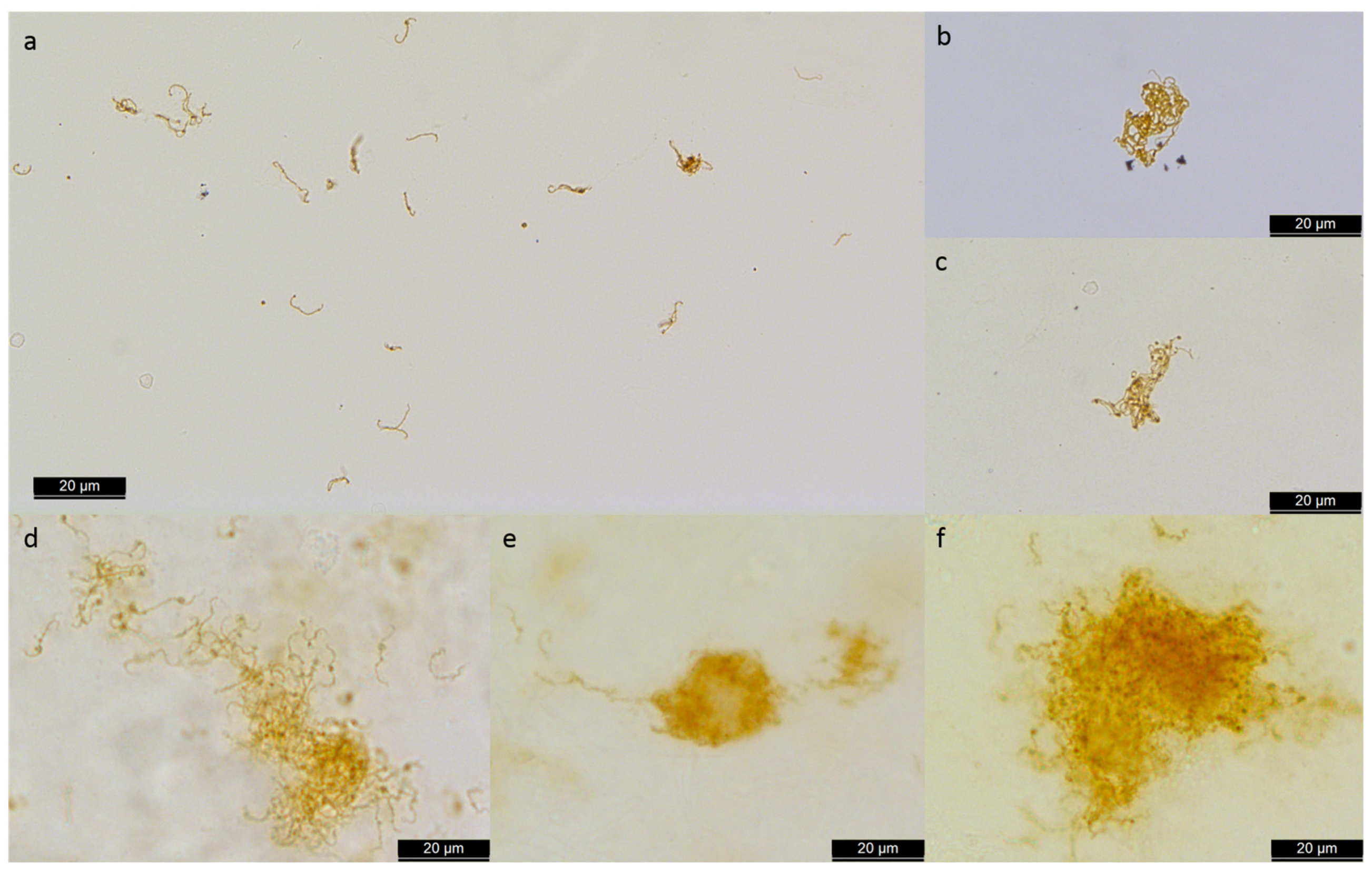 Microorganisms | Free Full-Text | Infectious Uveitis in Horses and New  Insights in Its Leptospiral Biofilm-Related Pathogenesis | HTML