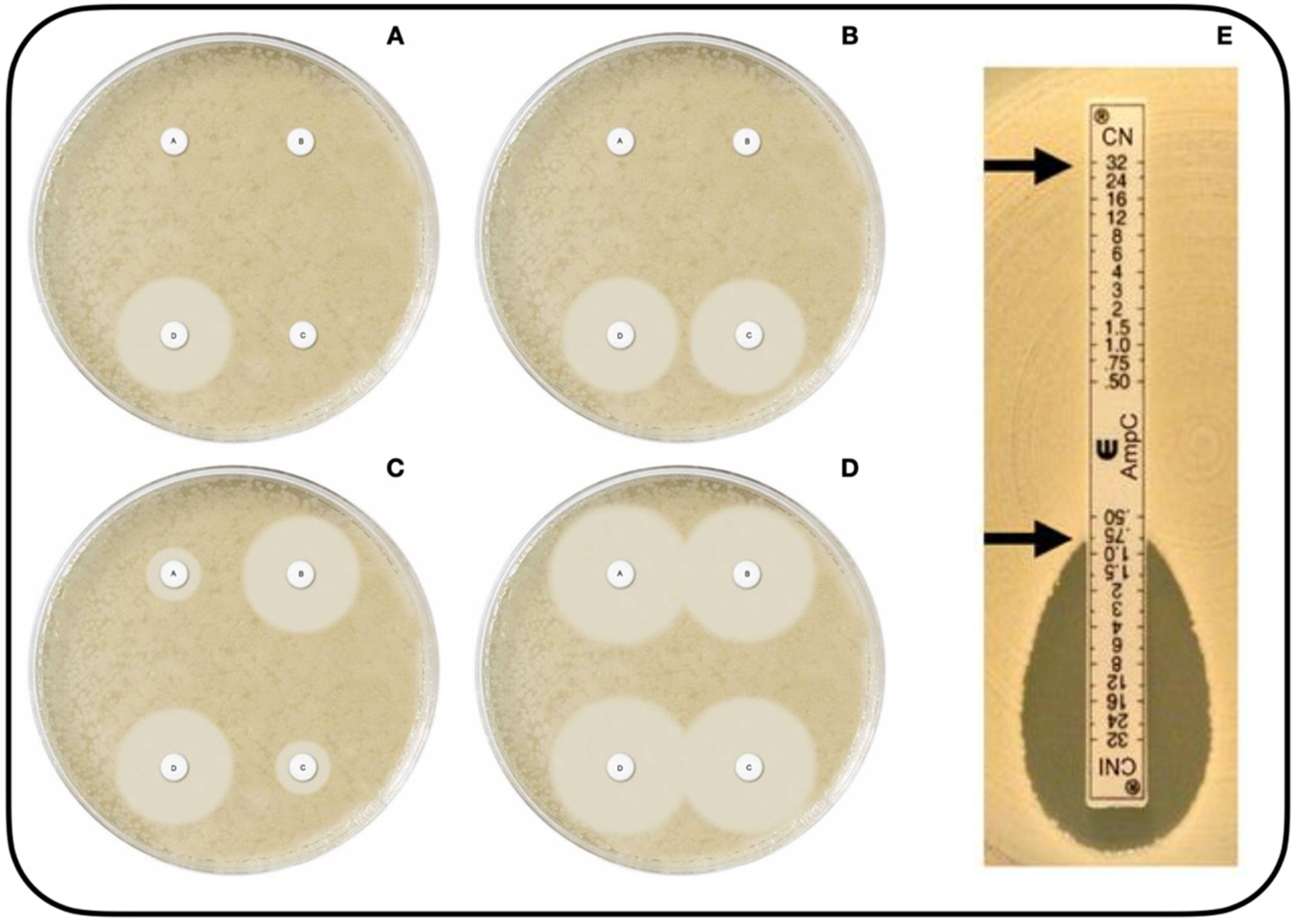 Microorganisms | Free Full-Text | Systematic Review of Plasmid AmpC Type  Resistances in Escherichia coli and Klebsiella pneumoniae and Preliminary  Proposal of a Simplified Screening Method for ampC