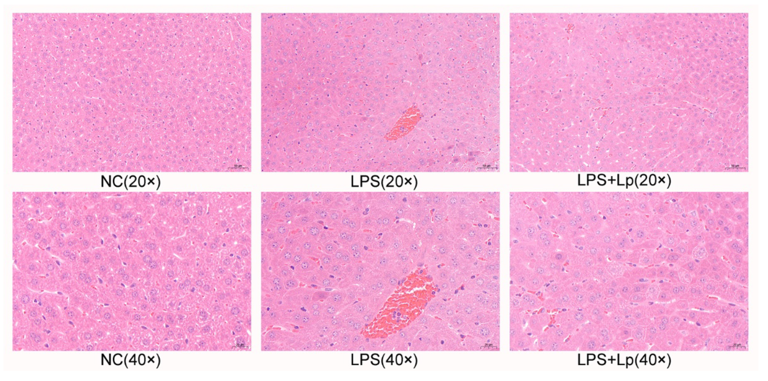 Protective Effects of Microbiome-Derived Inosine on  Lipopolysaccharide-Induced Acute Liver Damage and Inflammation in Mice via  Mediating the TLR4/NF-κB Pathway