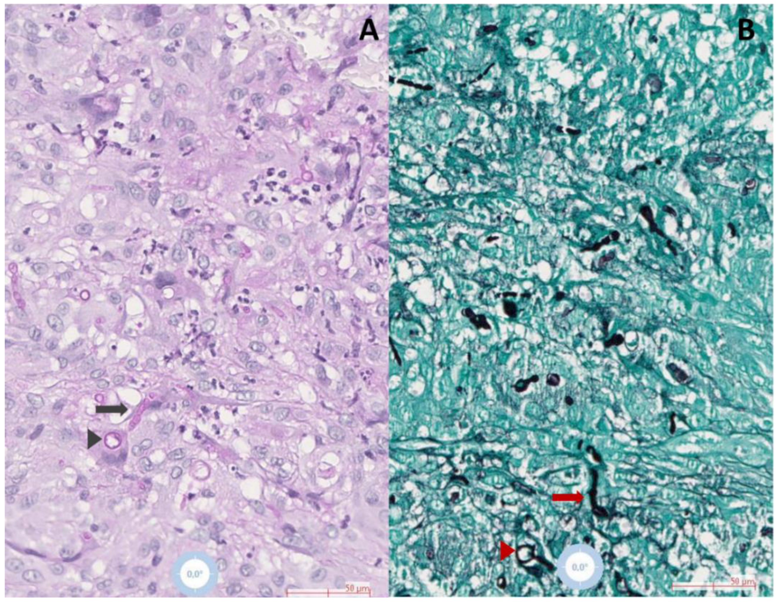 Microorganisms 11 00003 g001 Microorganisms 11 00003 g001