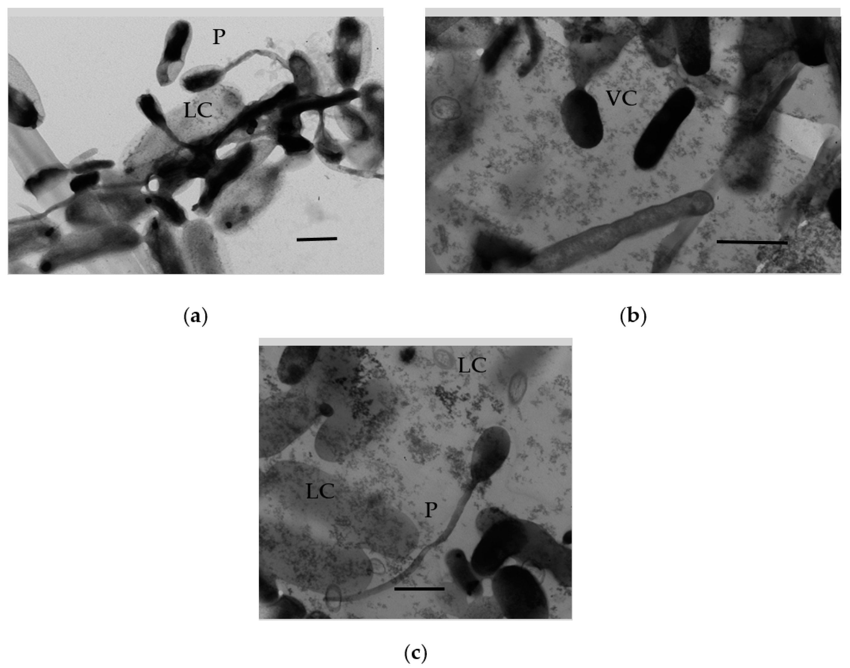 Microorganisms 11 01133 g009