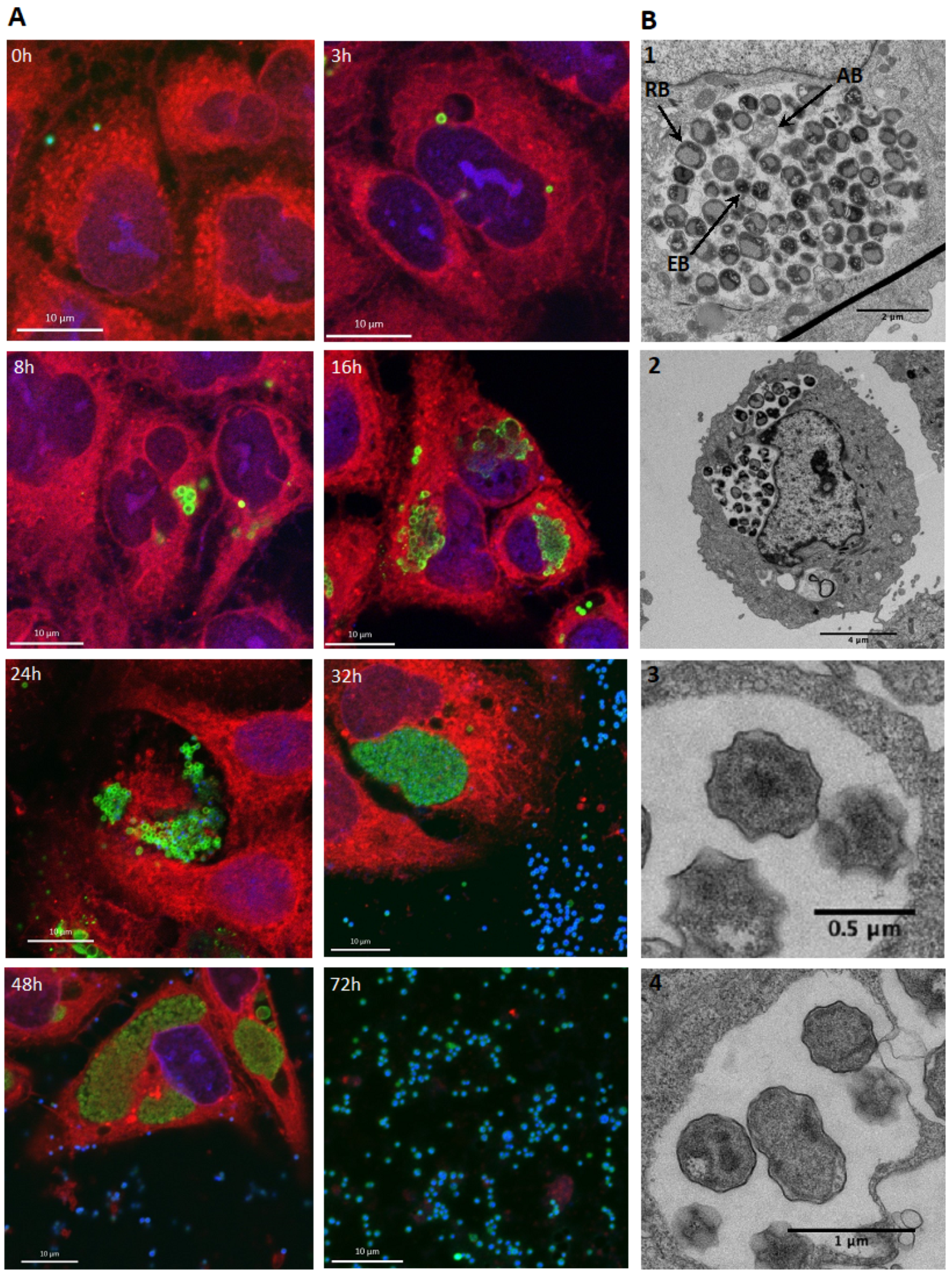 Microorganisms 11 02368 g002 Microorganisms 11 02368 g002