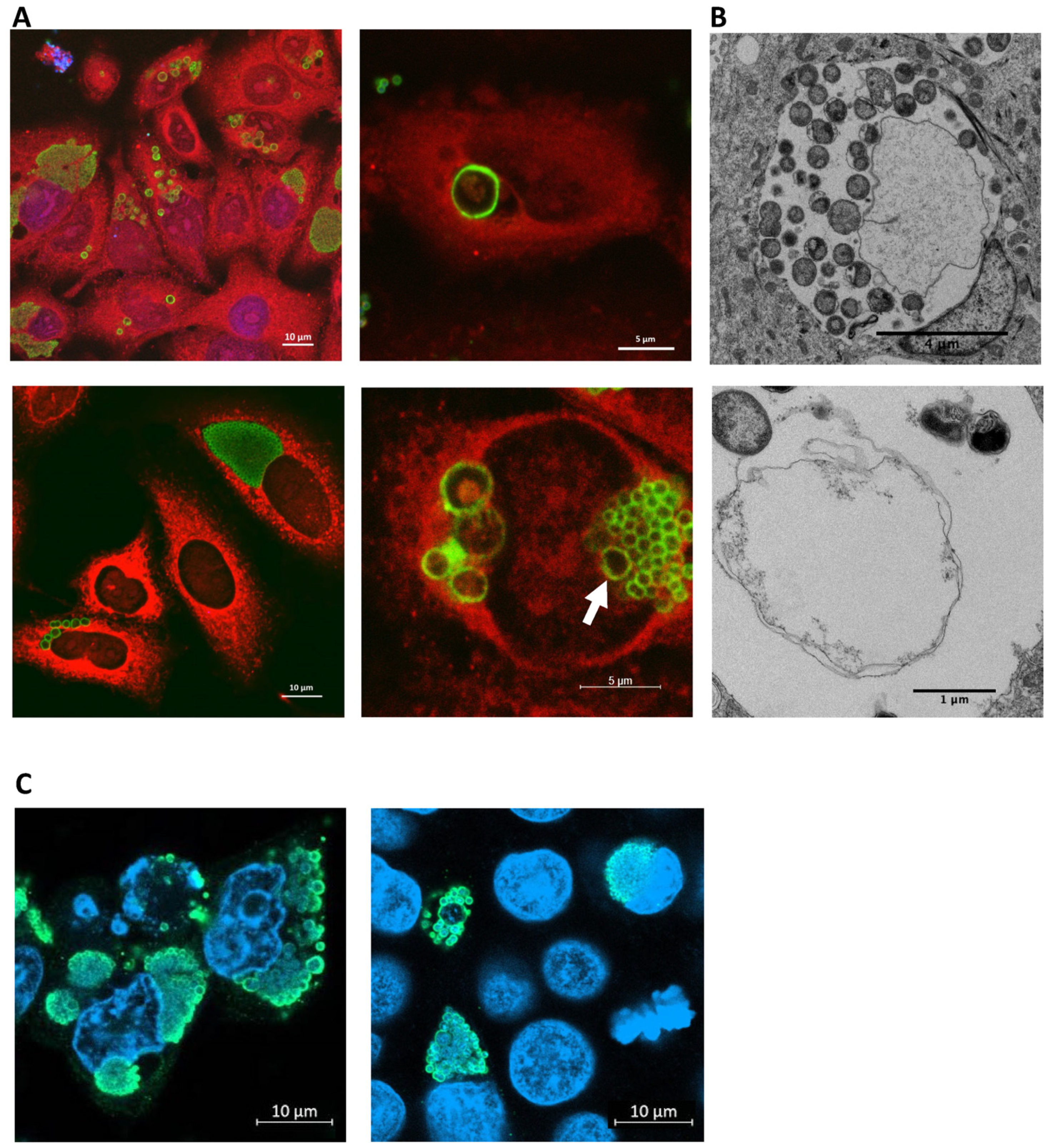 Microorganisms 11 02368 g003 Microorganisms 11 02368 g003