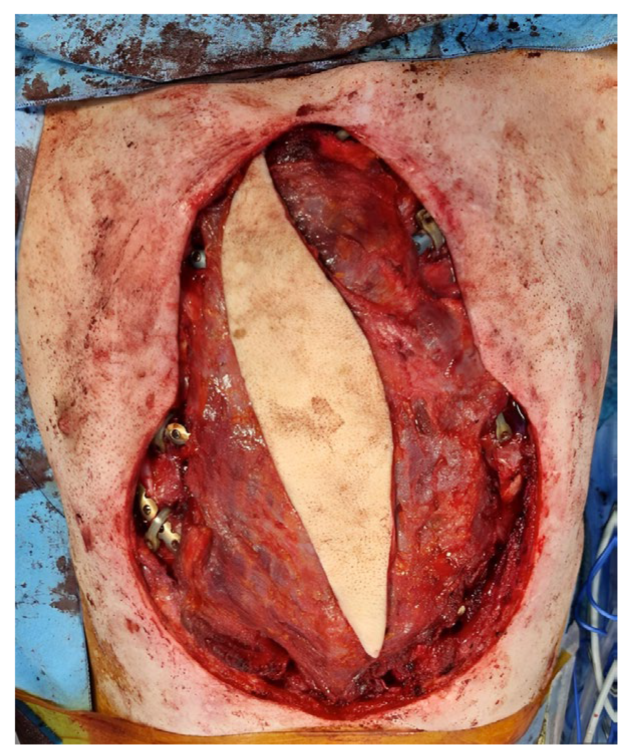 Microorganisms 11 02699 g006 Microorganisms 11 02699 g006