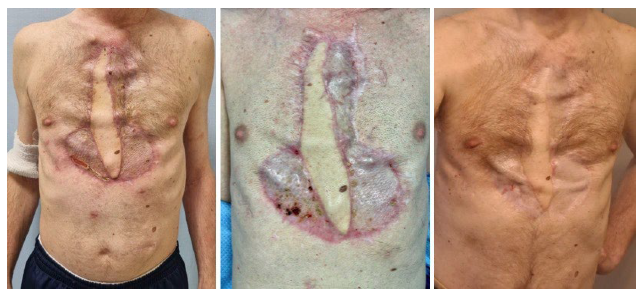 Microorganisms 11 02699 g007 Microorganisms 11 02699 g007