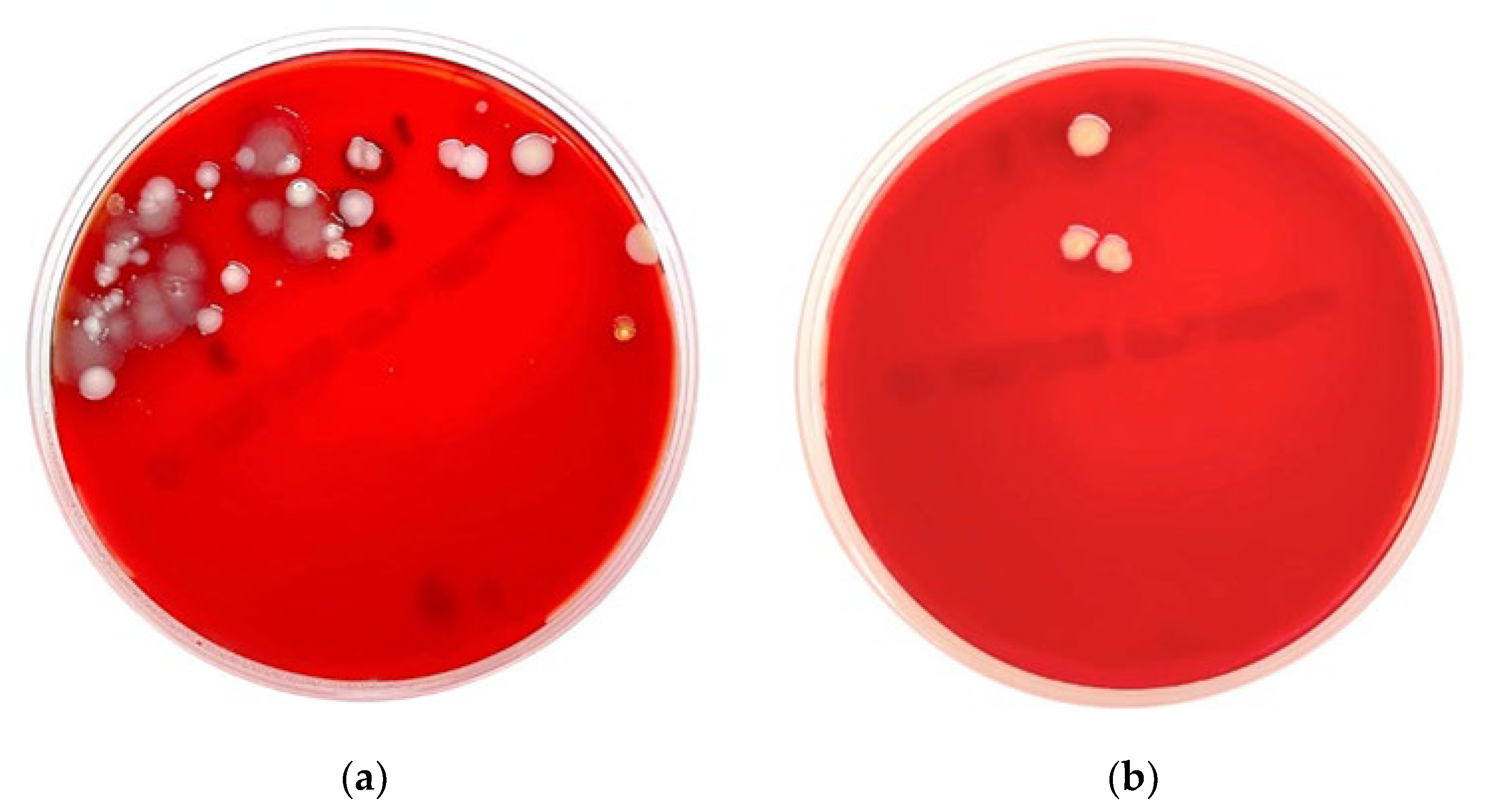 Microorganisms 11 02855 g002