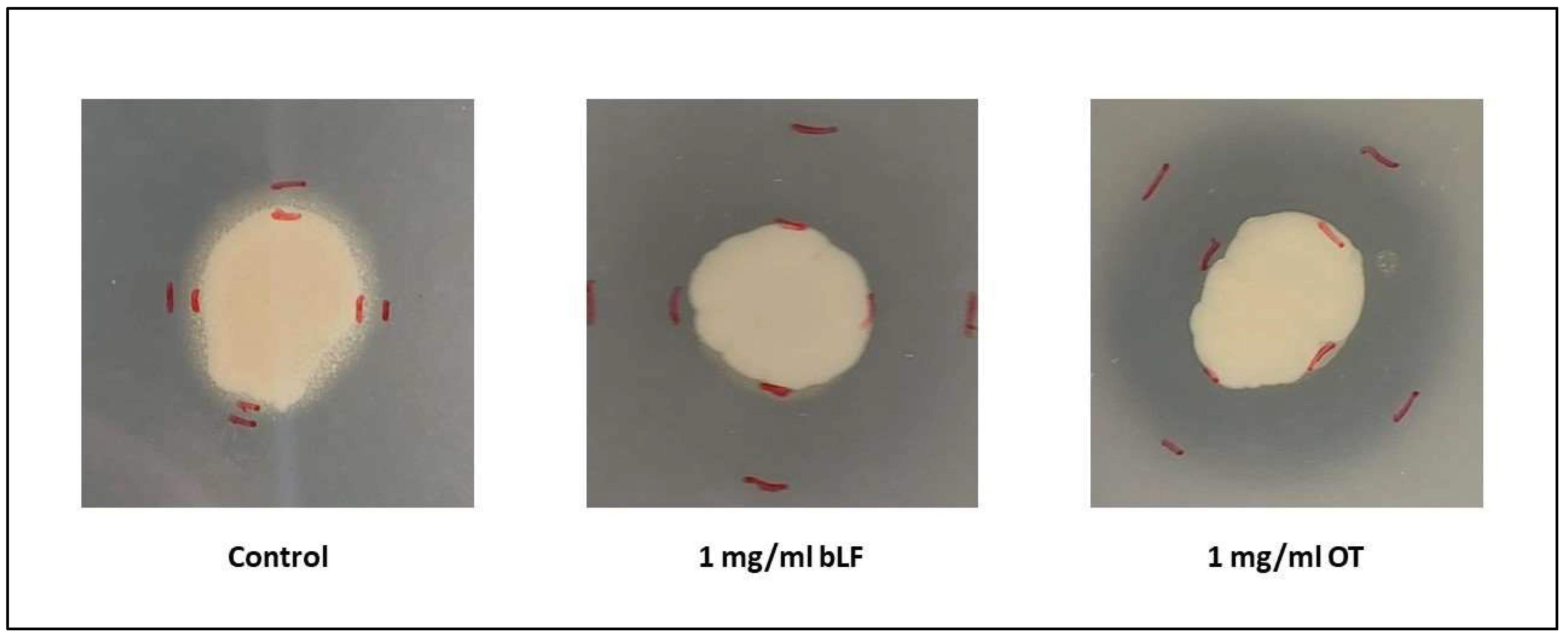 Microorganisms 11 02912 g010