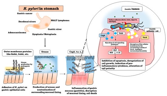 Microorganisms | Free Full-Text | Helicobacter pylori: A ...