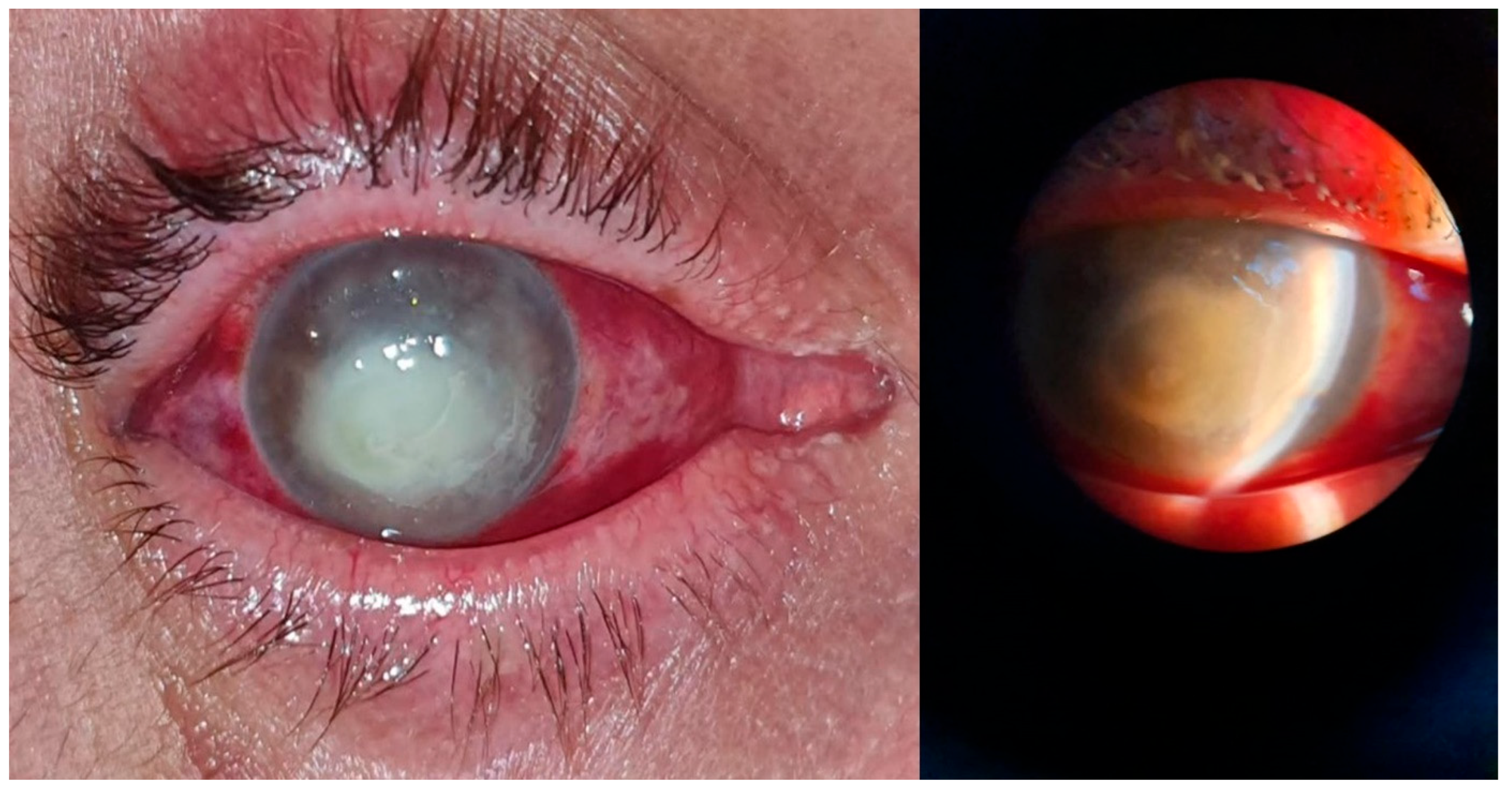 Microorganisms 12 00787 g003