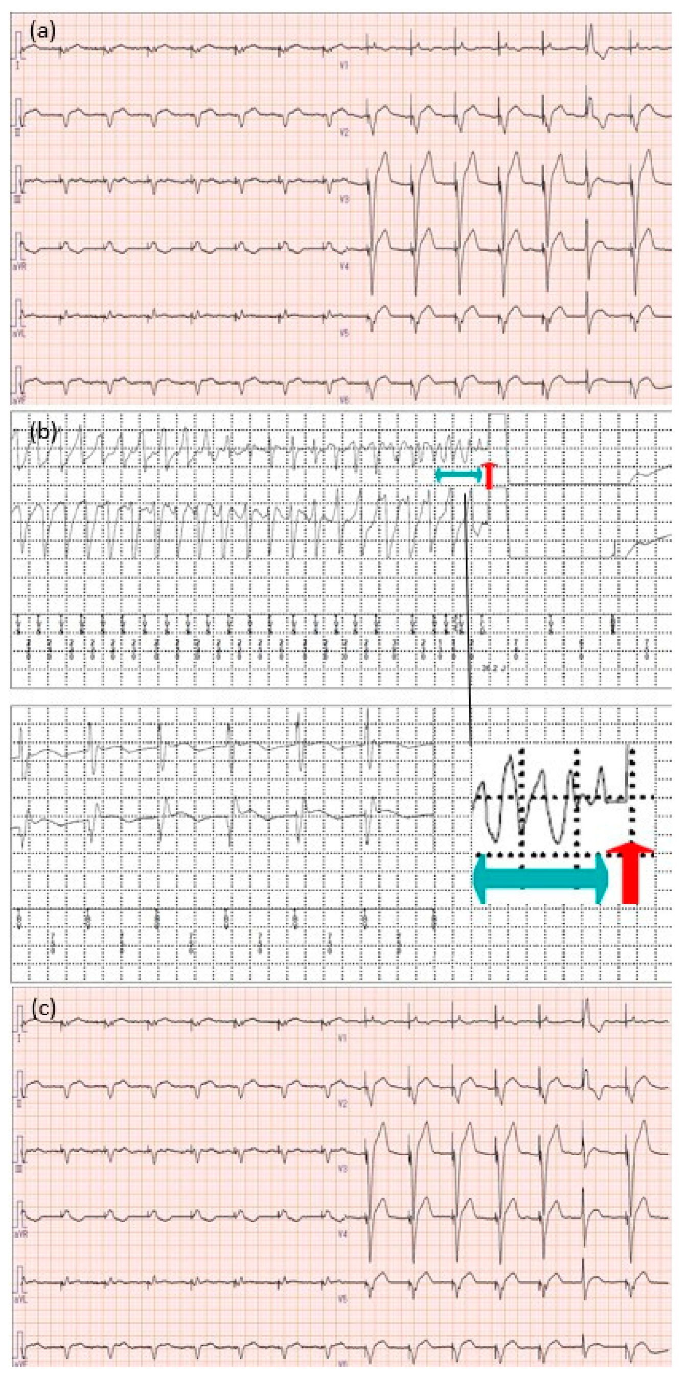 Microorganisms 12 01619 g002 Microorganisms 12 01619 g002