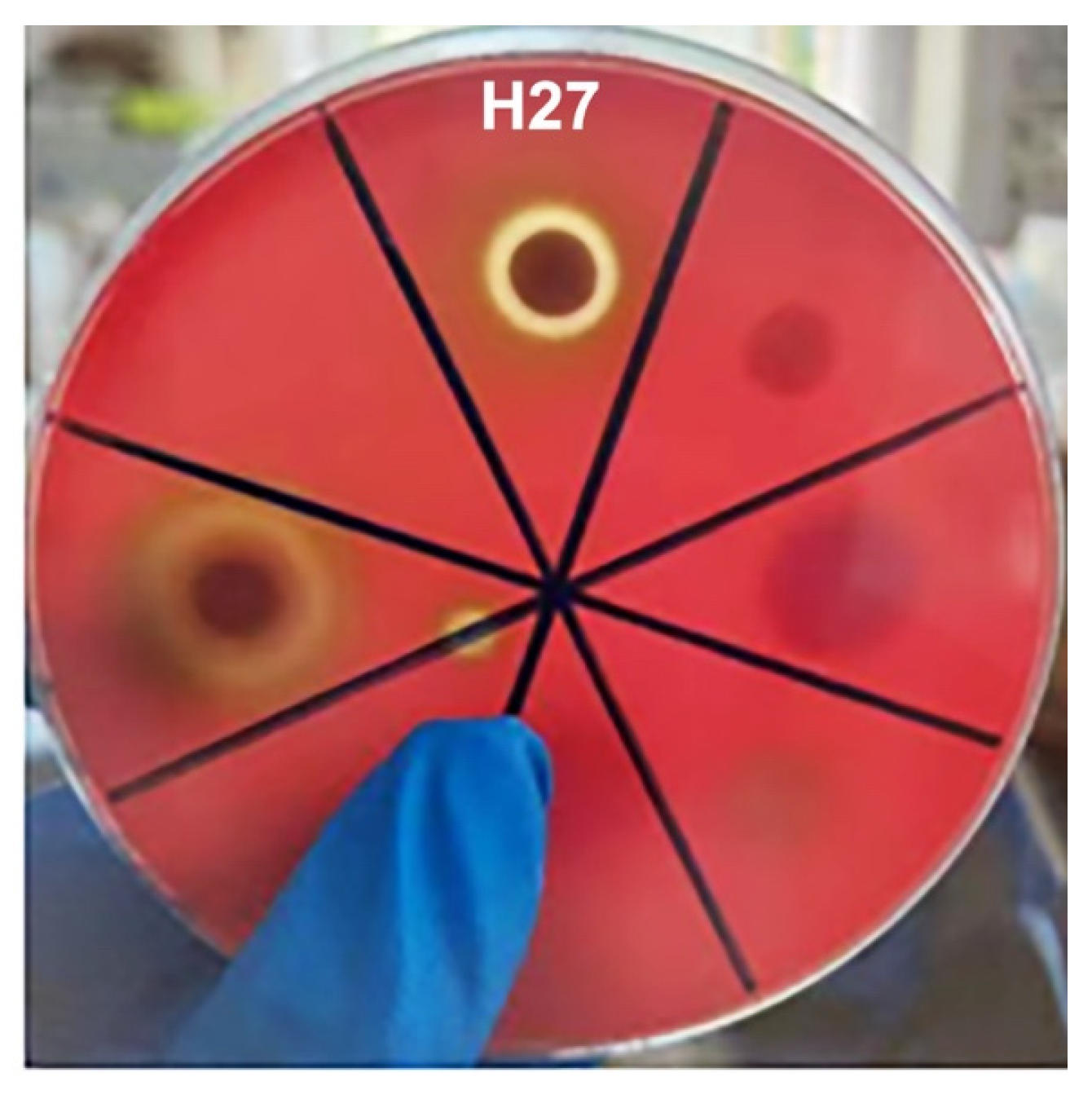 Microorganisms 13 00296 g004 Microorganisms 13 00296 g004