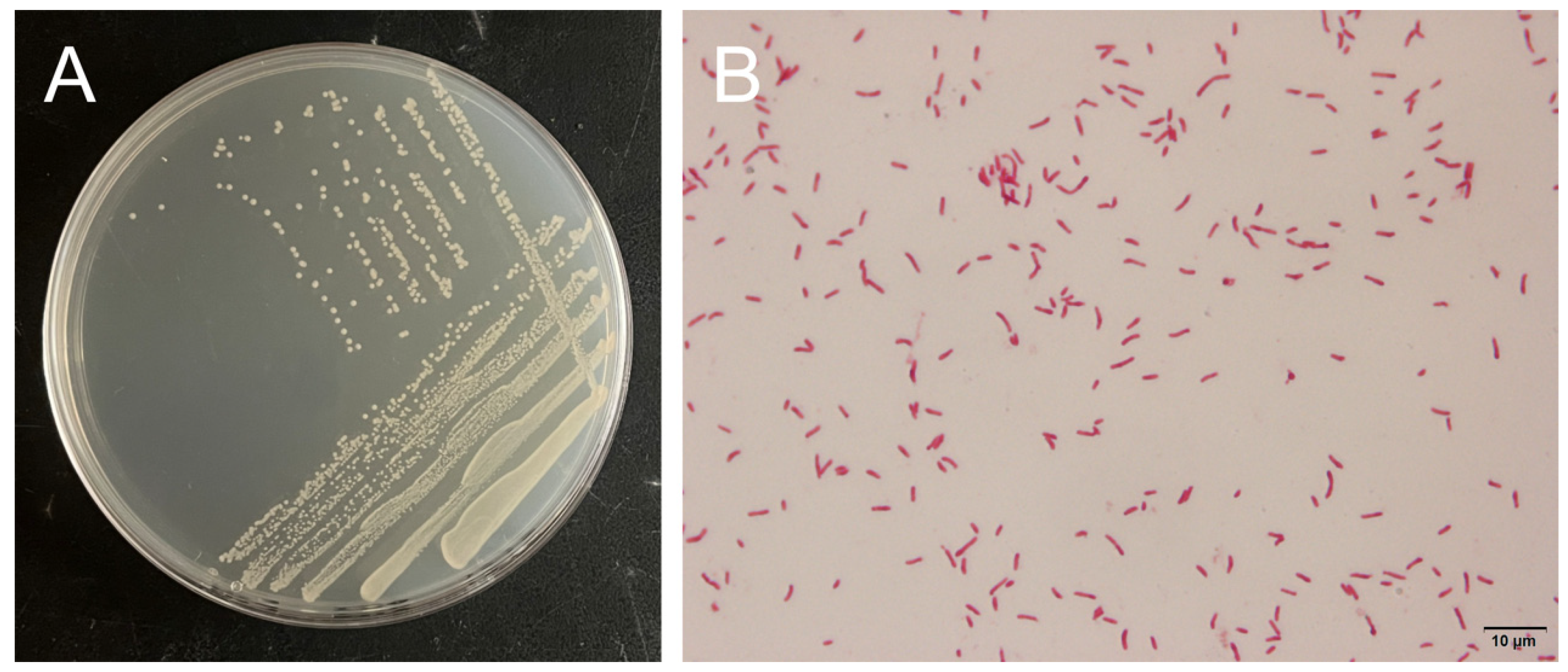 Microorganisms 13 00296 g005 Microorganisms 13 00296 g005