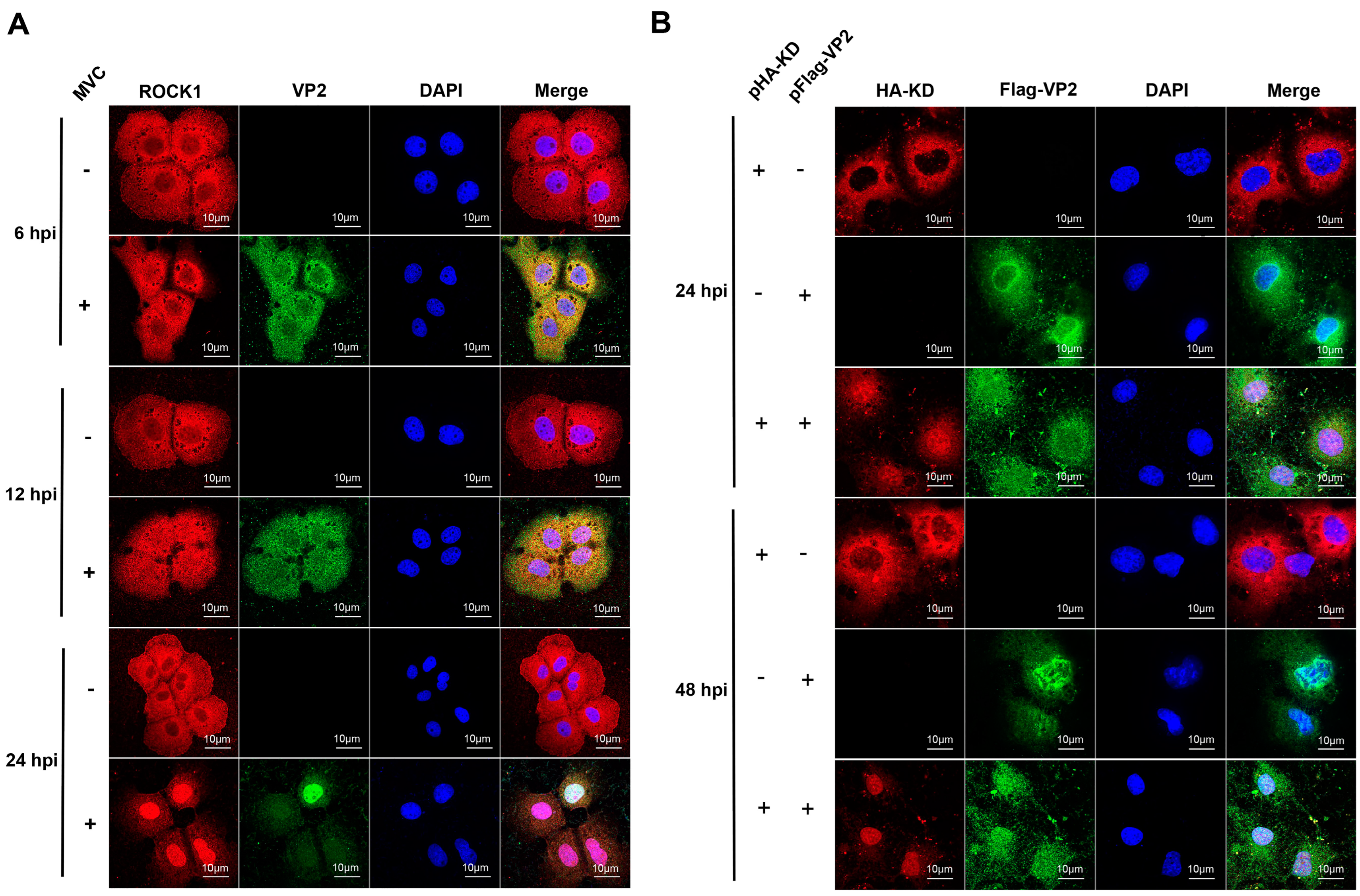 Microorganisms 13 00695 g004