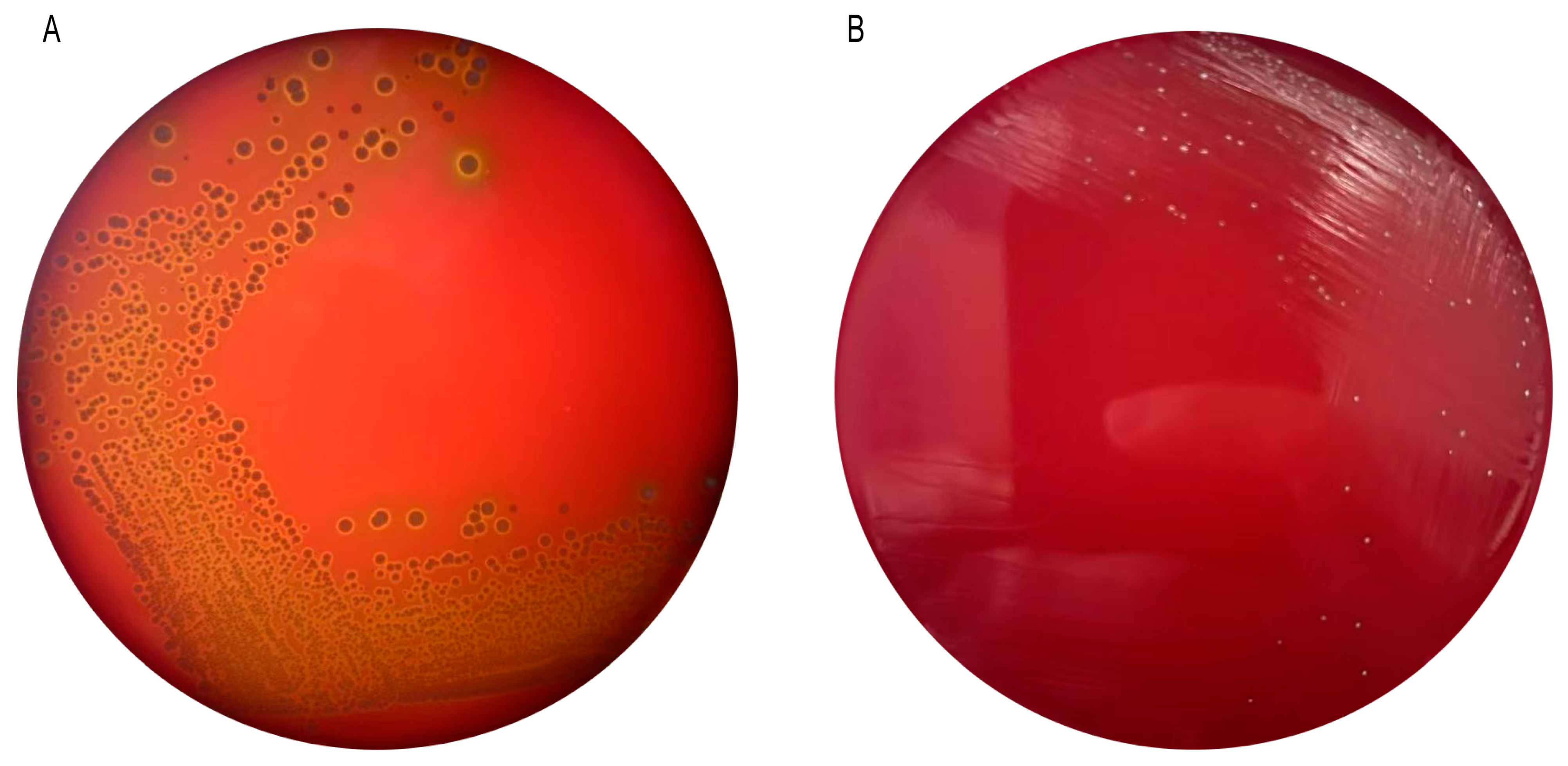 Microorganisms 13 00957 g003