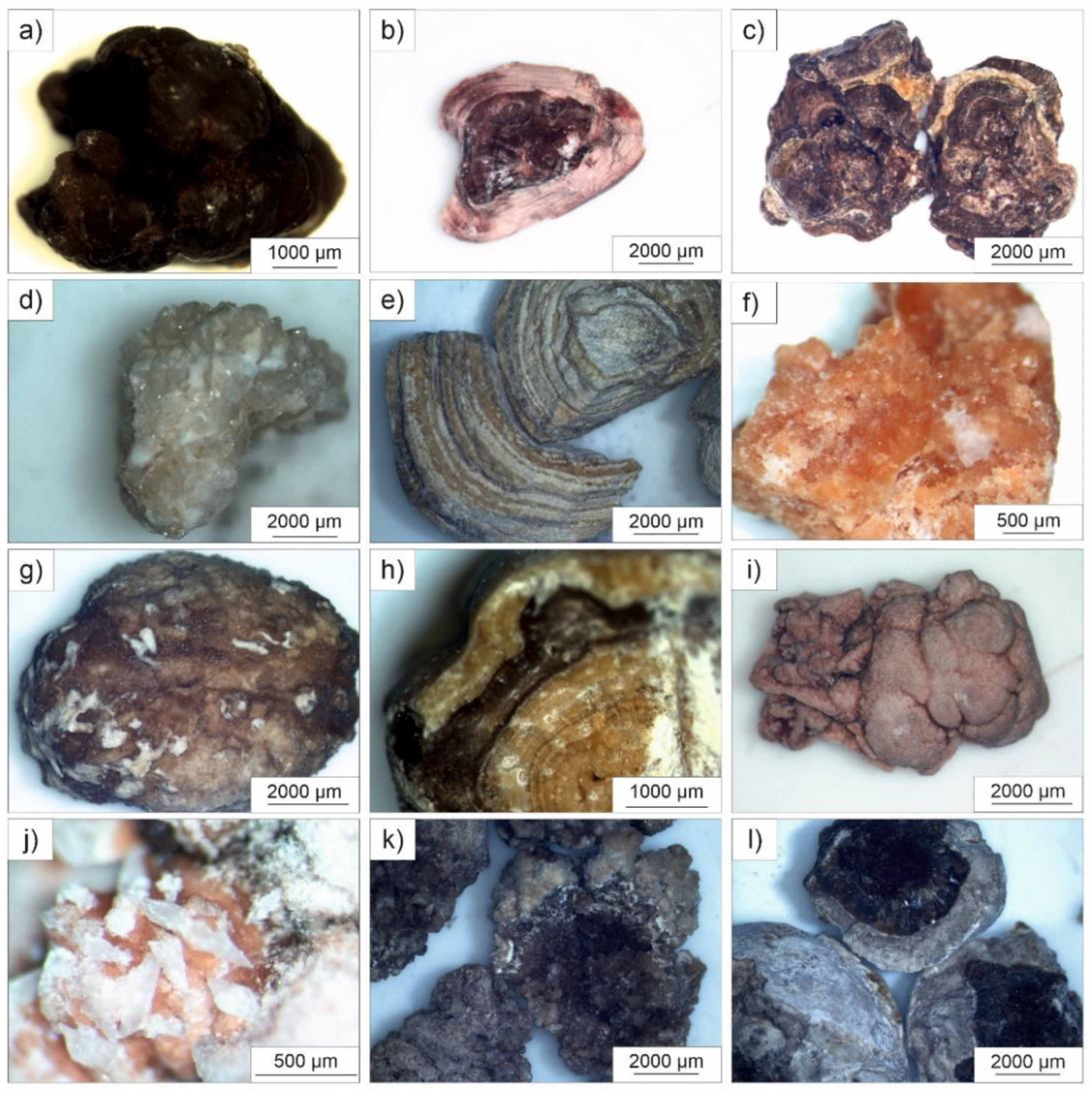 Minerals | Free Full-Text | Morpho-Constitutional Classification of Urinary  Stones as Prospective Approach for the Management of Human Pathological  Biomineralization: New Insights from Southern Italy