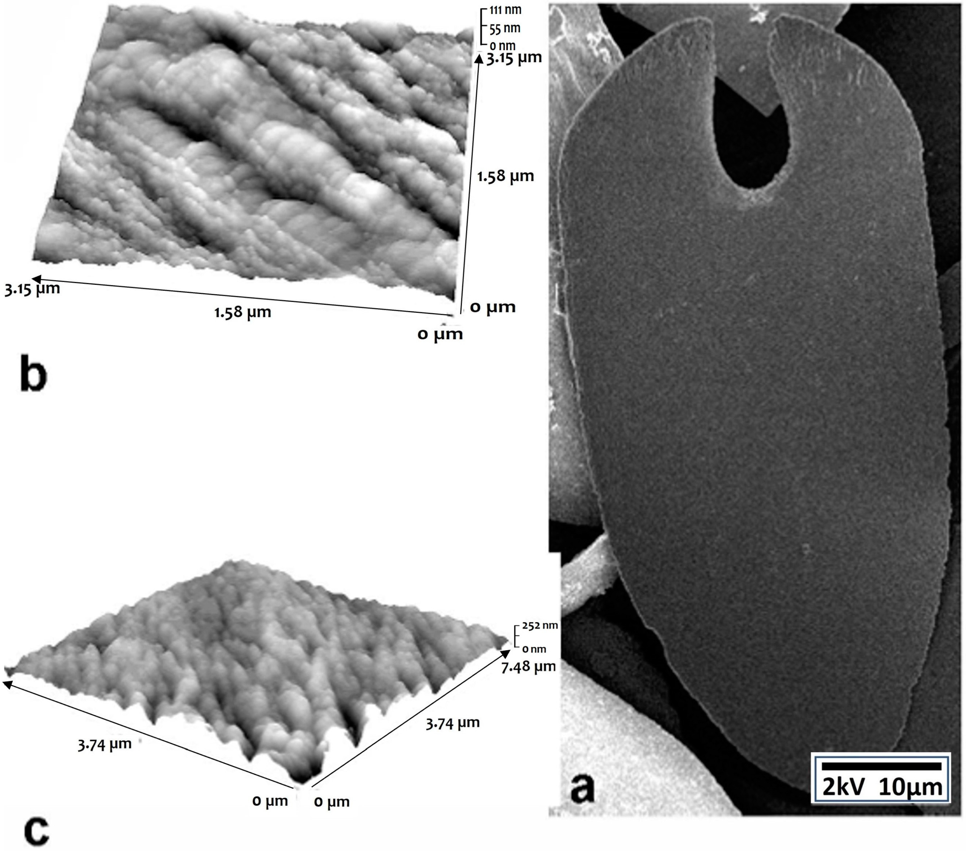 Minerals | Free Full-Text | The Caudofoveata (Mollusca) Spicule as