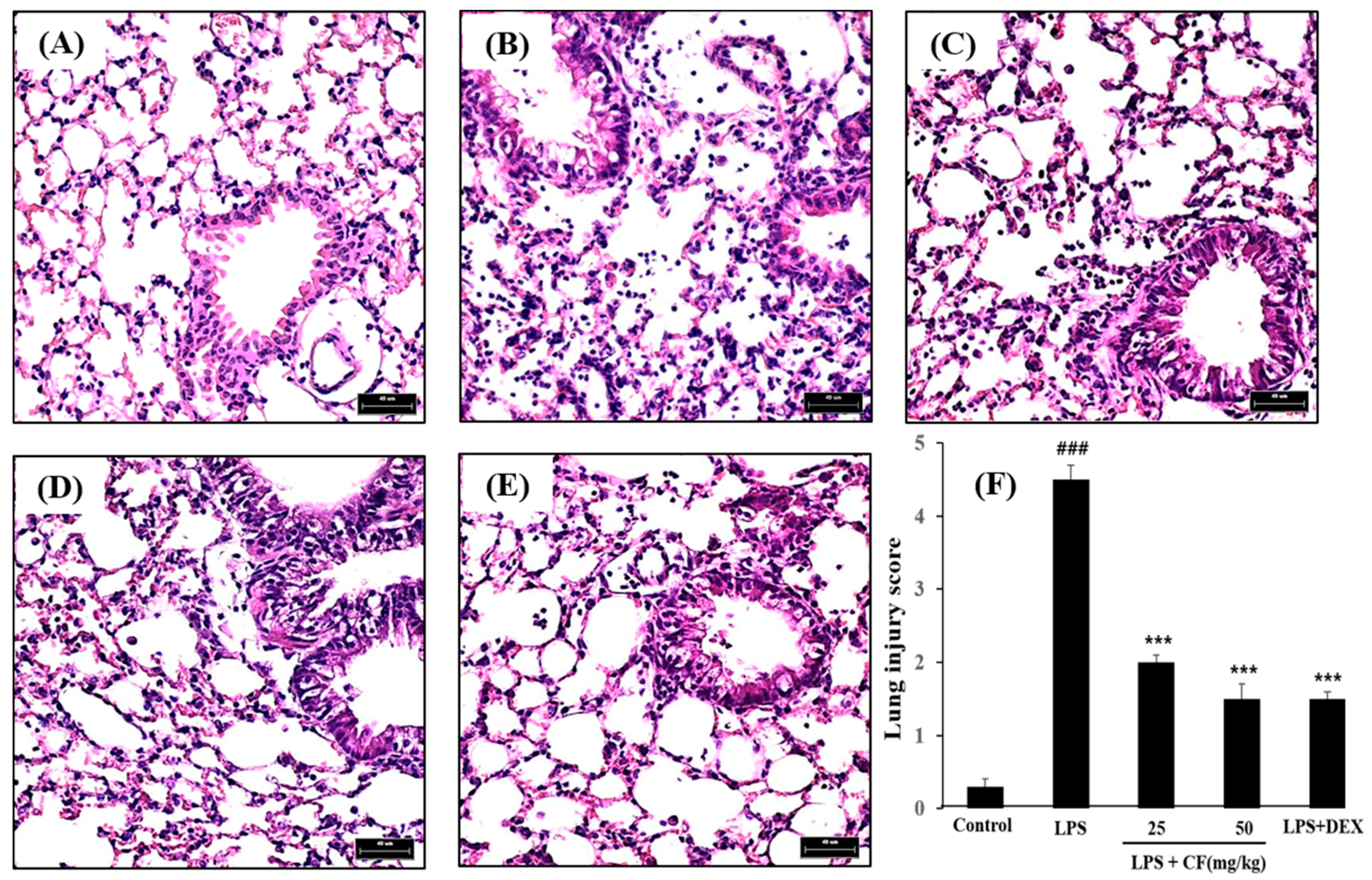 Molecules | Free Full-Text | Trapa japonica Pericarp Extract Reduces LPS-Induced  Inflammation in Macrophages and Acute Lung Injury in Mice
