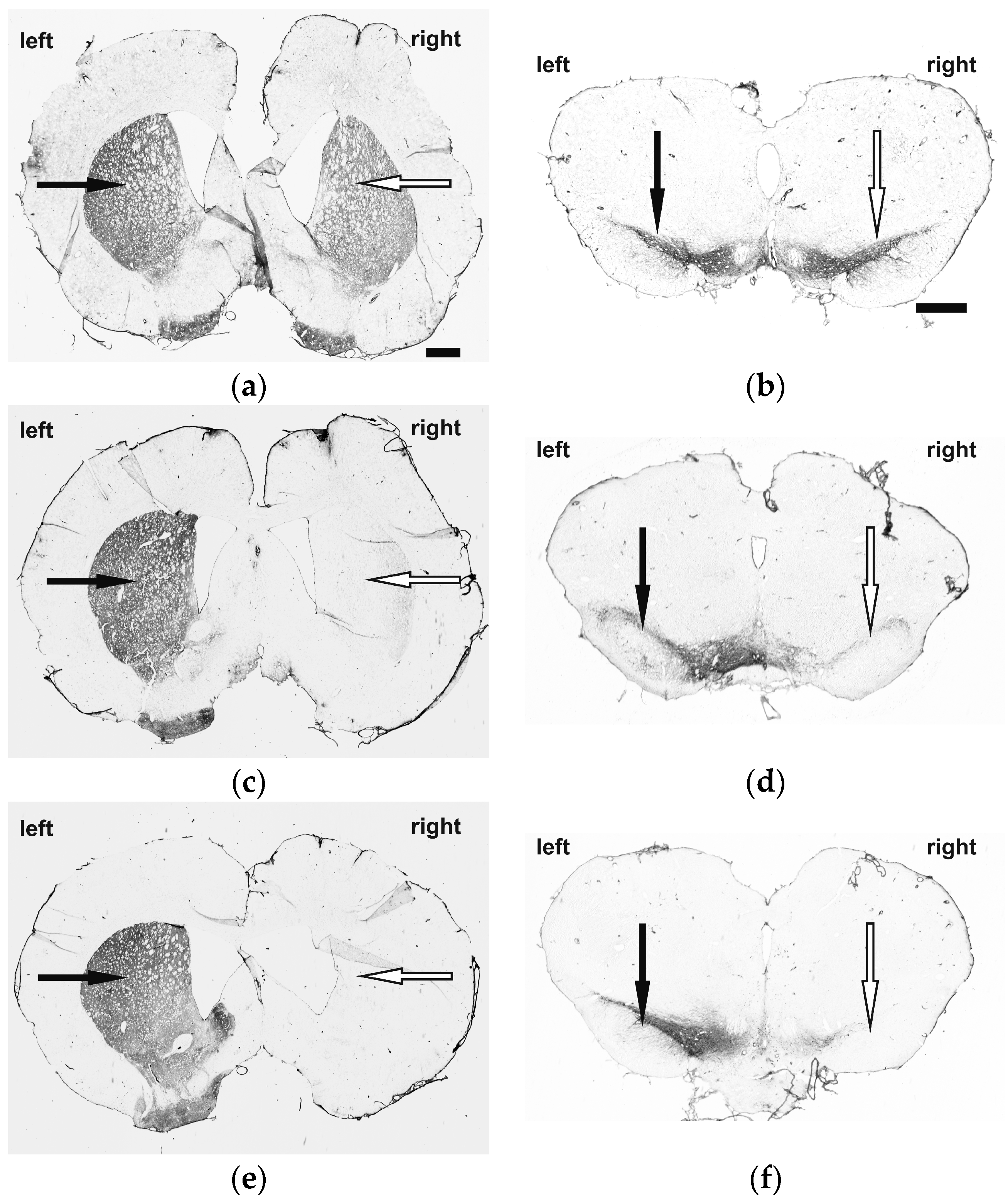 Molecules | Free Full-Text | [18F]fallypride-PET/CT Analysis of the  Dopamine D2/D3 Receptor in the Hemiparkinsonian Rat Brain Following  Intrastriatal Botulinum Neurotoxin A Injection | HTML