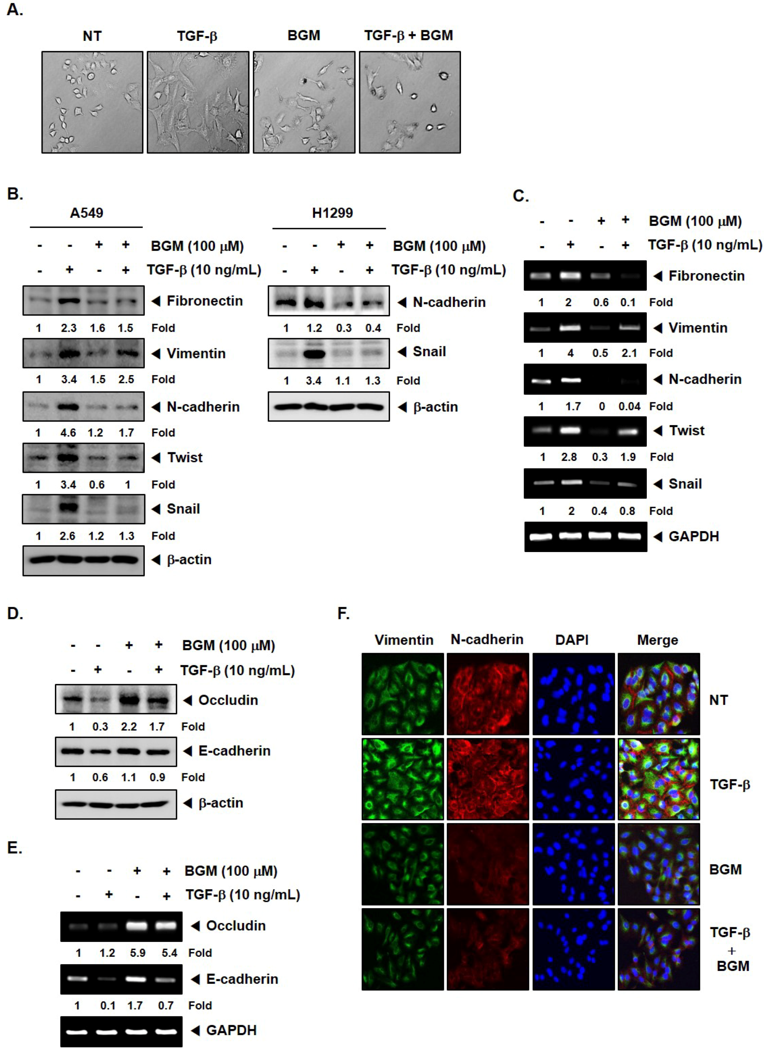 Molecules Free Full Text Bergamottin Suppresses Metastasis Of Lung Cancer Cells Through Abrogation Of Diverse Oncogenic Signaling Cascades And Epithelial To Mesenchymal Transition