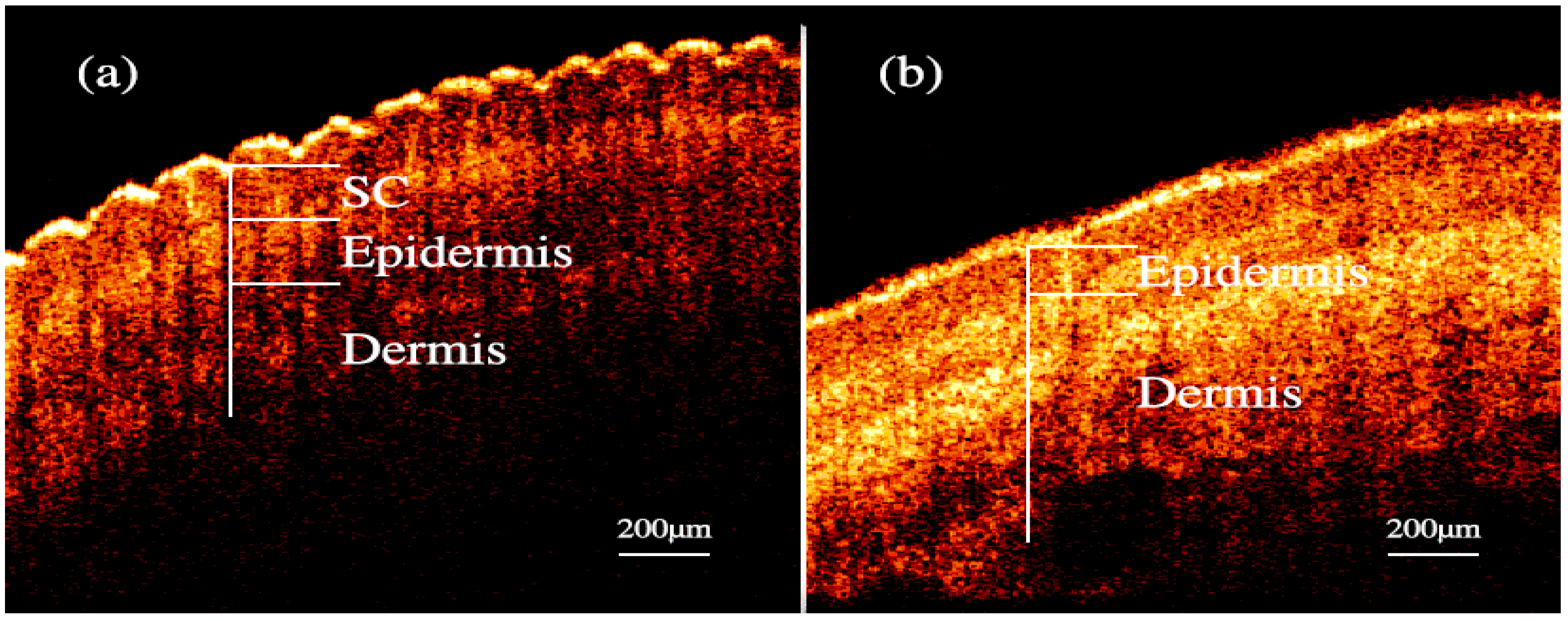 Noninvasive Free | | A Full-Text Molecules Accurate ...