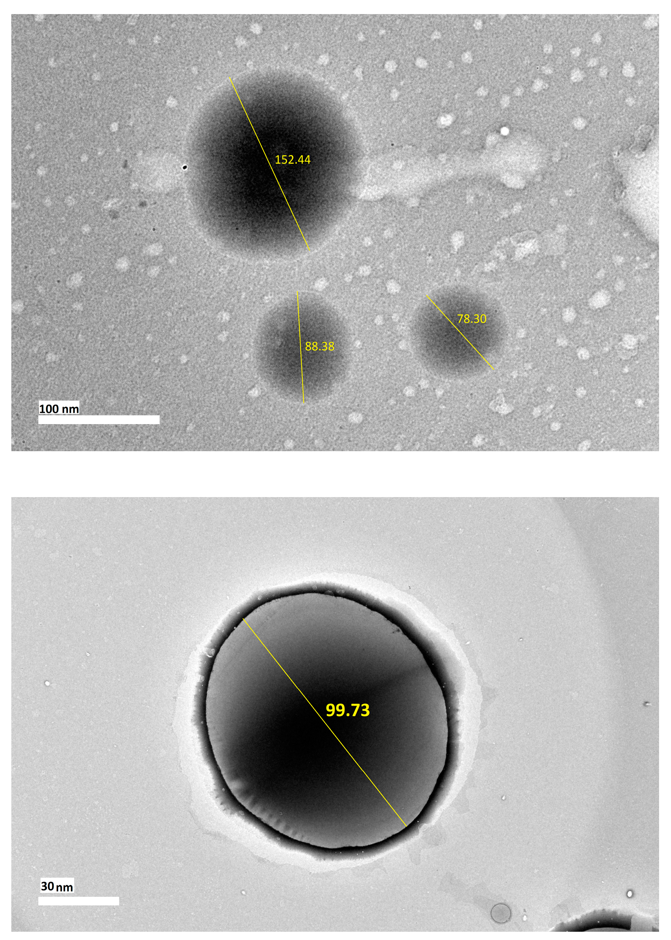 Molecules Free Full Text An Improved Nanoemulsion Formulation Containing Kojic Monooleate Optimization Characterization And In Vitro Studies Html