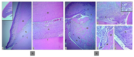 Molecules | Free Full-Text | Effect of Pistacia atlantica subsp. kurdica  Gum in Experimental Periodontitis Induced in Wistar Rats by Utilization of  Osteoclastogenic Bone Markers