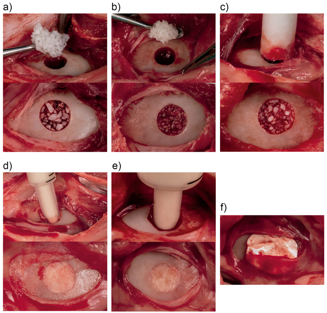 Molecules | Free Full-Text | Collagenated Porcine Heterologous Bone Grafts:  Histomorphometric Evaluation of Bone Formation Using Different Physical  Forms in a Rabbit Cancellous Bone Model