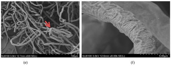 Molecules Free Full Text Growth Restriction Of Rhizoctonia Solani Via Breakage Of Intracellular Organelles Using Crude Extracts Of Gallnut And Clove Html