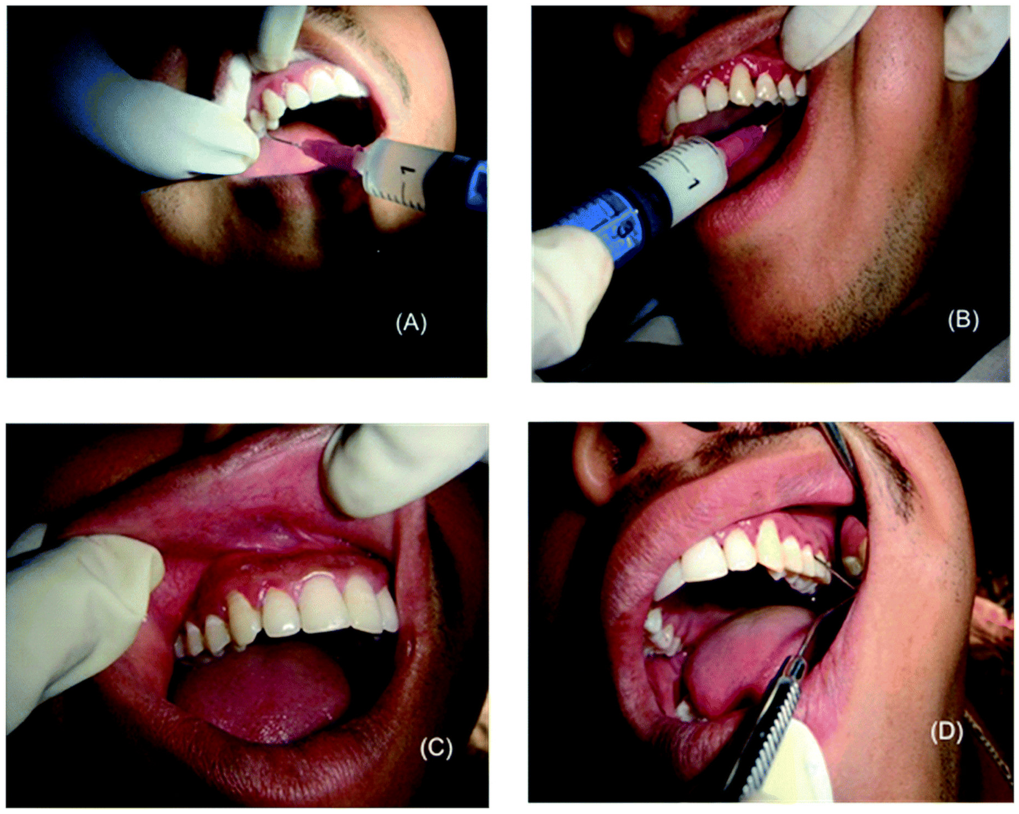 Molecules 26 02229 g010 Molecules 26 02229 g010