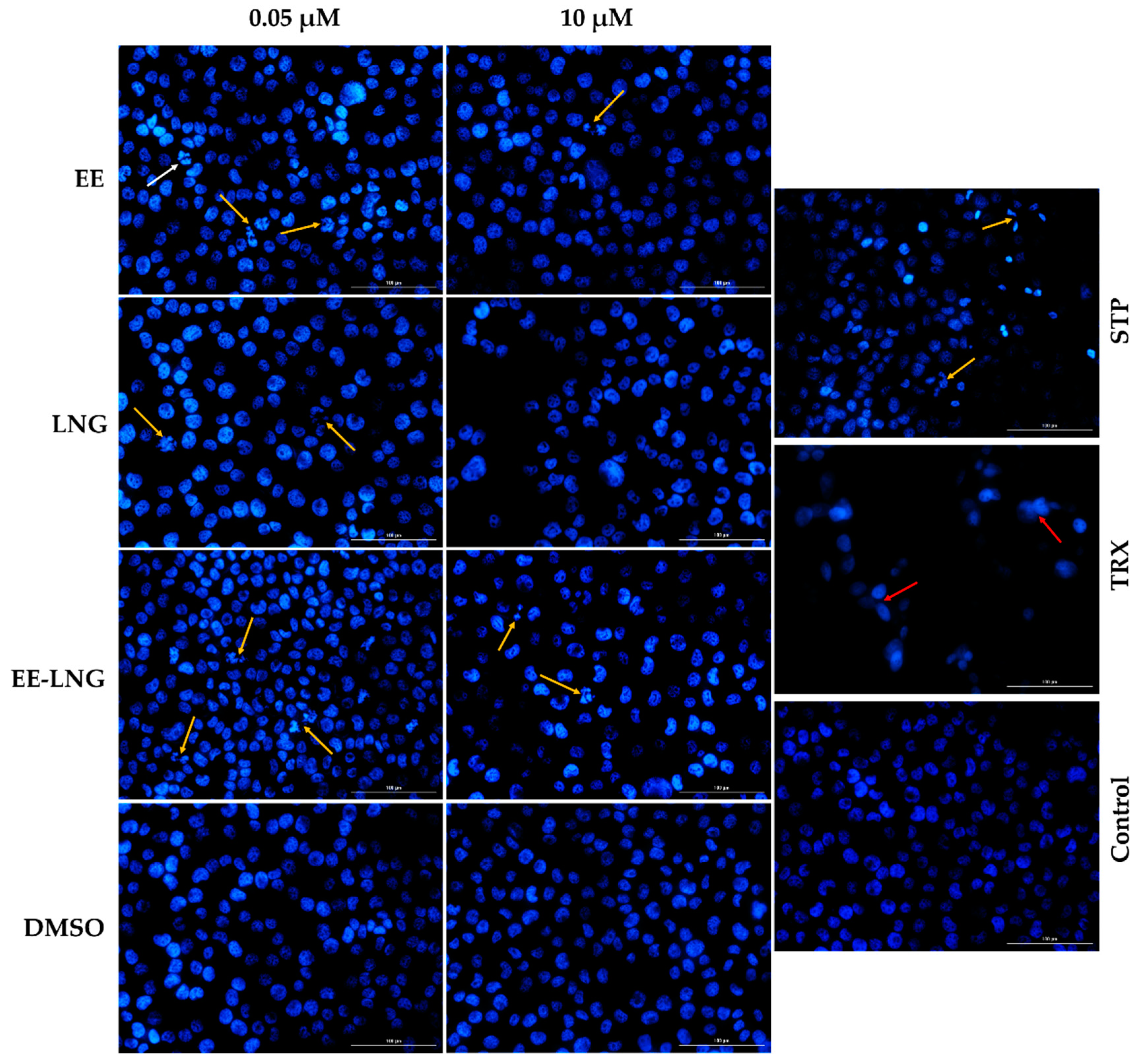 Molecules | Free Full-Text | Insights into the Behavior of Triple-Negative  MDA-MB-231 Breast Carcinoma Cells Following the Treatment with  17β-Ethinylestradiol and Levonorgestrel | HTML