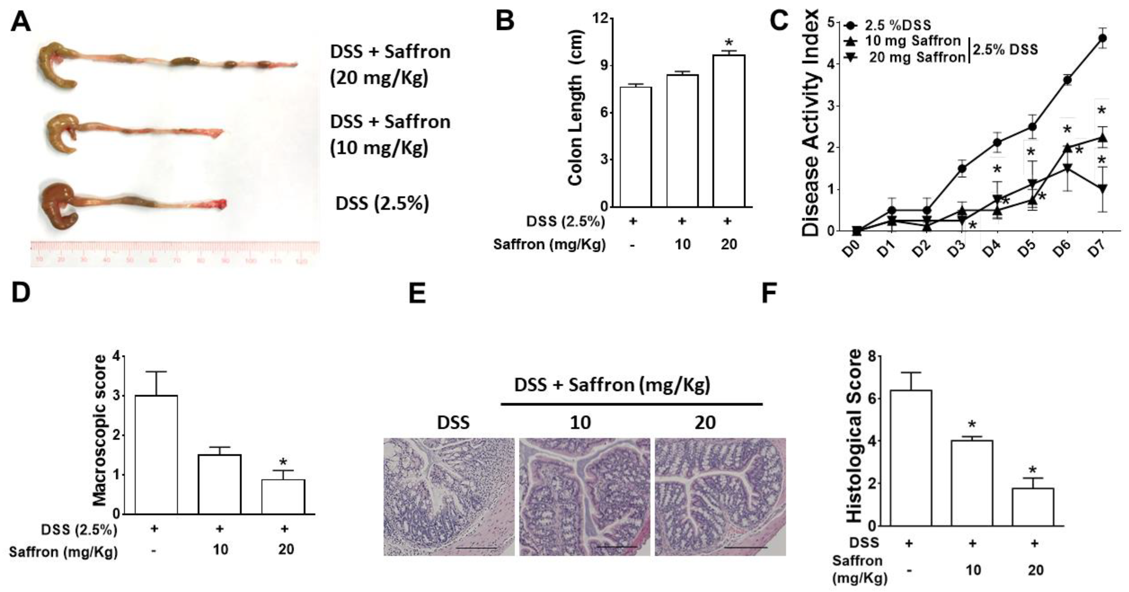 Molecules | Free Full-Text | Saffron Pre-Treatment Promotes Reduction in  Tissue Inflammatory Profiles and Alters Microbiome Composition in  Experimental Colitis Mice