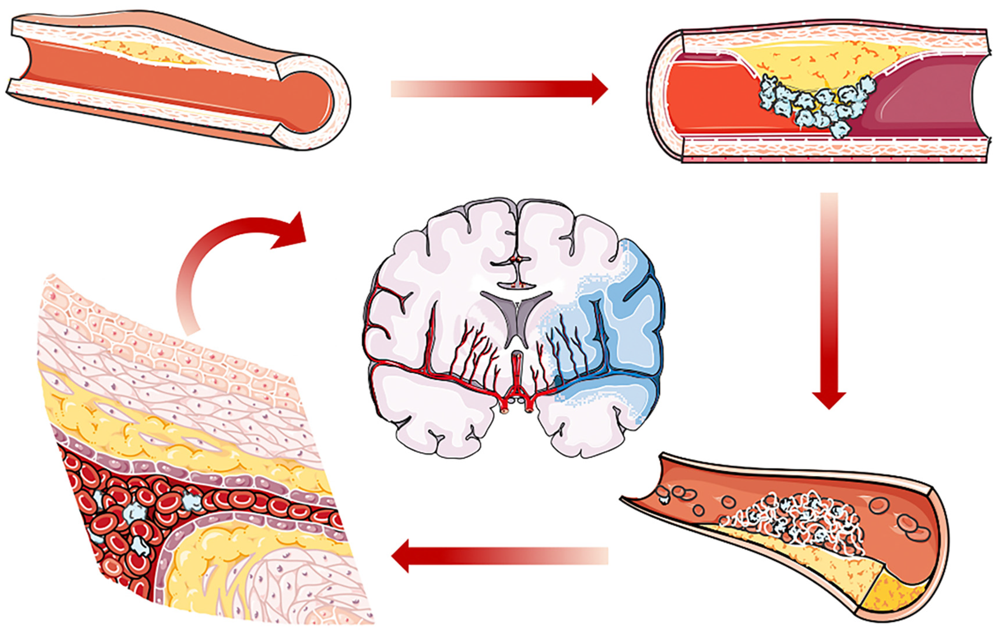 Molecules Free Full Text Recent Advances Of Cell Membrane Coated Nanoparticles In Treating Cardiovascular Disorders Html