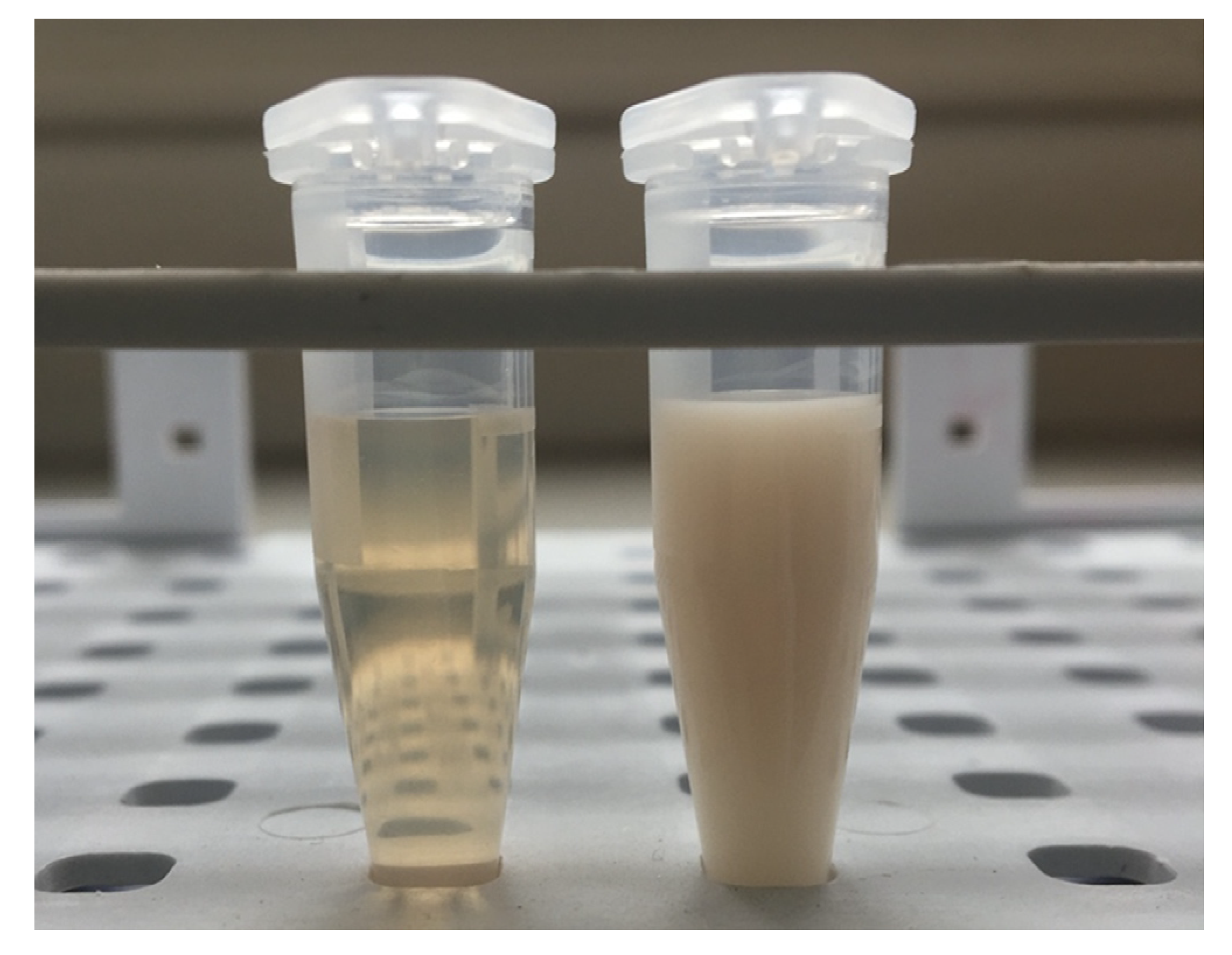 Molecules Free FullText Lipemia in the Plasma Sample Affects