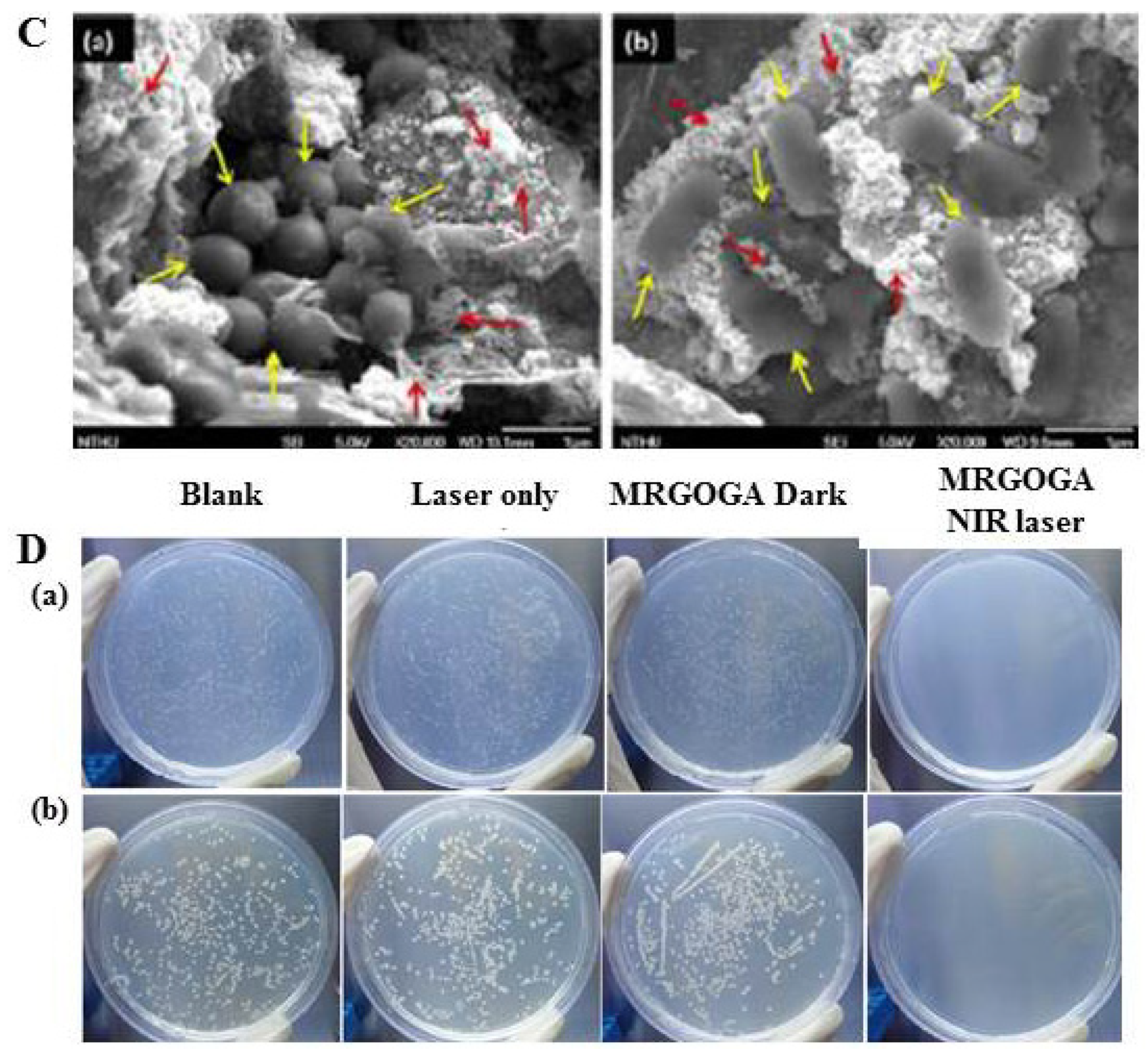 Molecules Free Full Text Multimodal Imaging And Phototherapy Of Cancer And Bacterial