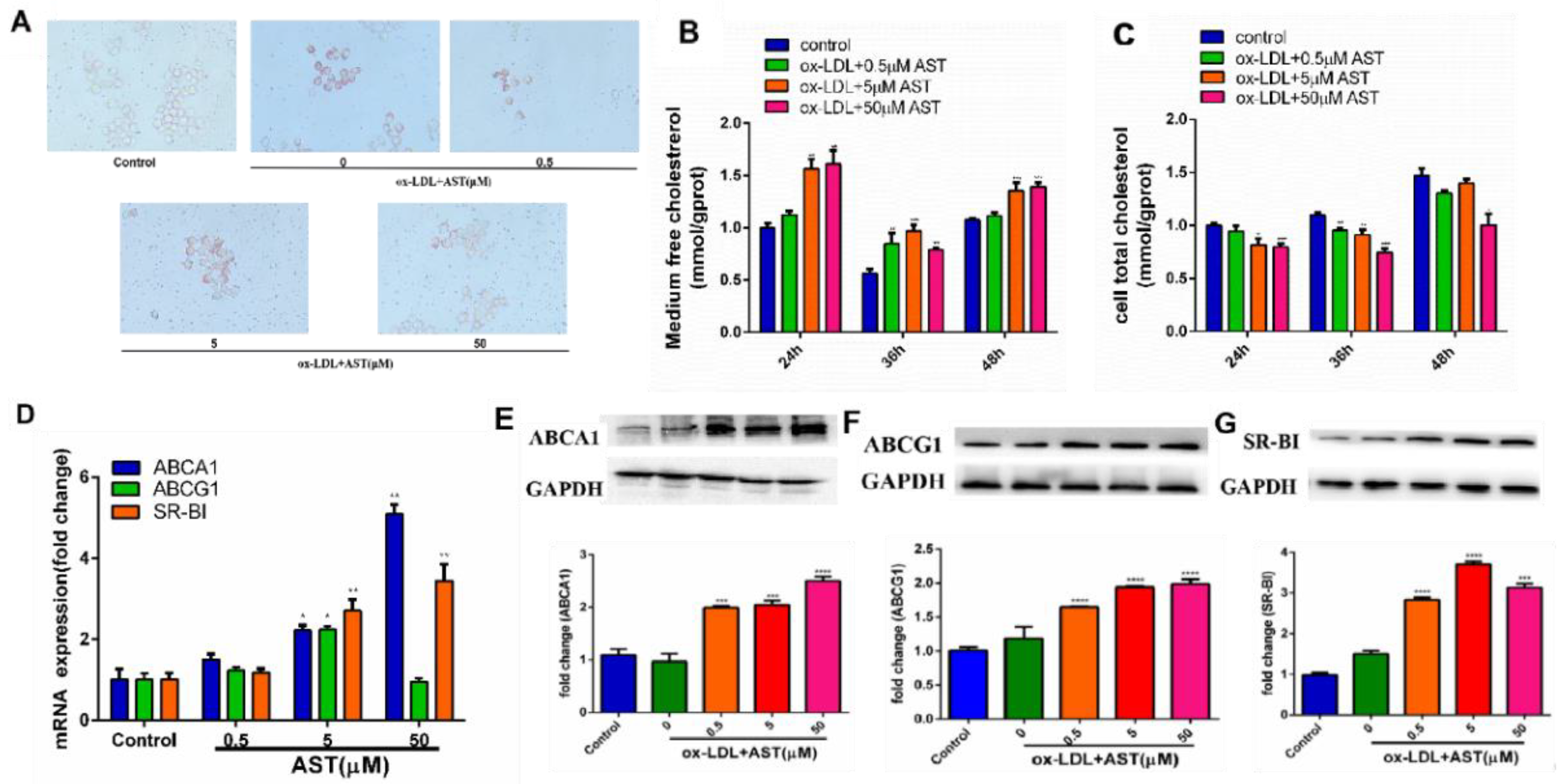 Molecules | Free Full-Text | Astaxanthin Alleviates Foam Cell 