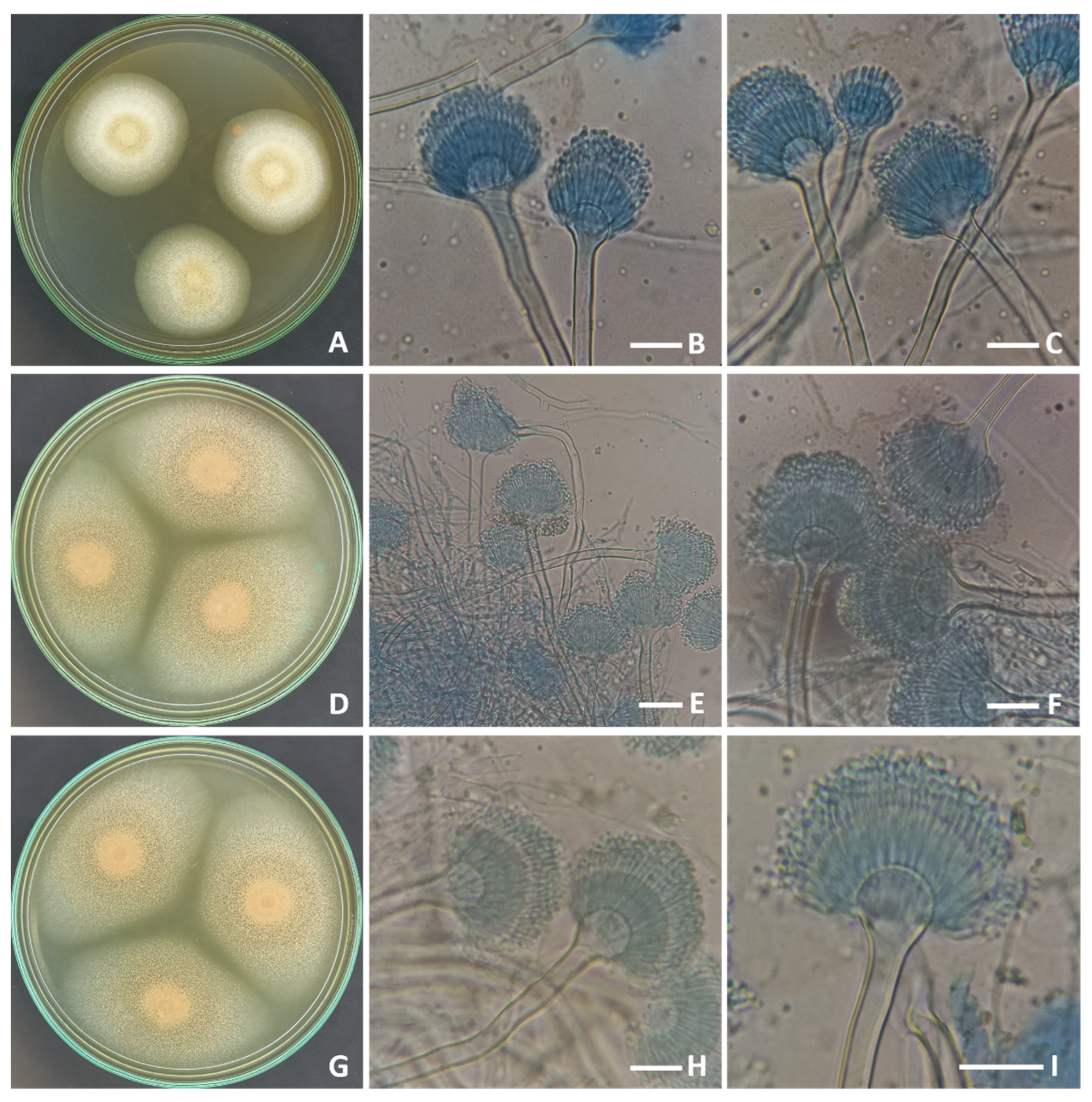 Molecules | Free Full-Text | Exploitation of Sugarcane Bagasse and