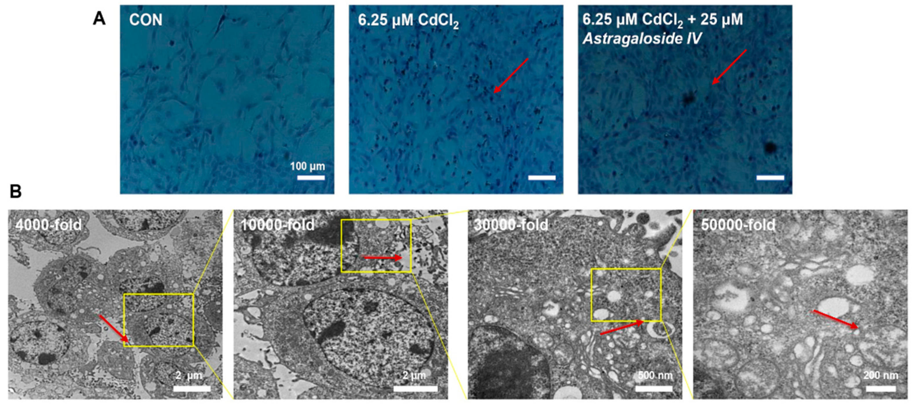 Molecules | Free Full-Text | Protective Effect of Astragaloside IV 