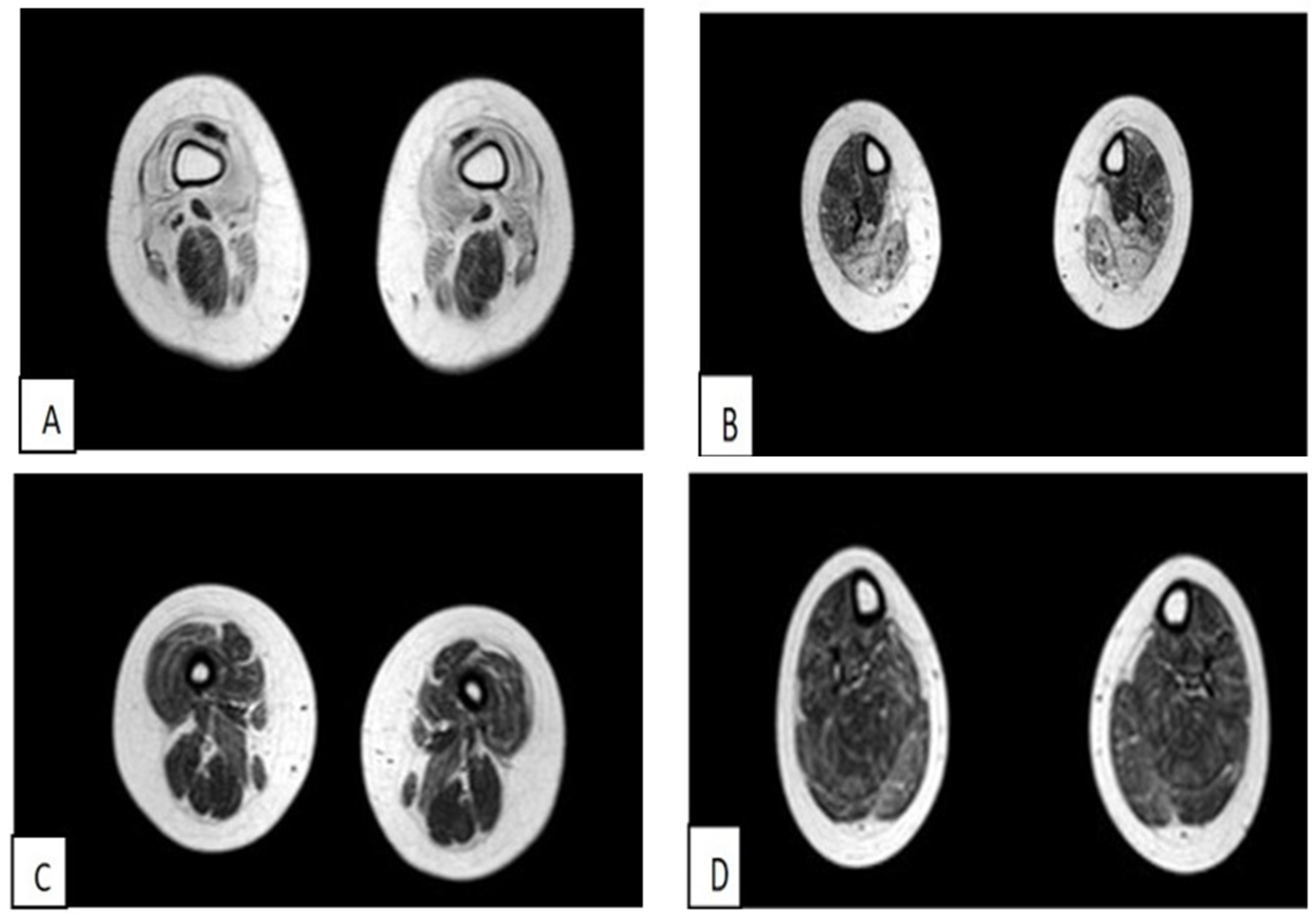 Muscles 02 00021 g001 Muscles 02 00021 g001
