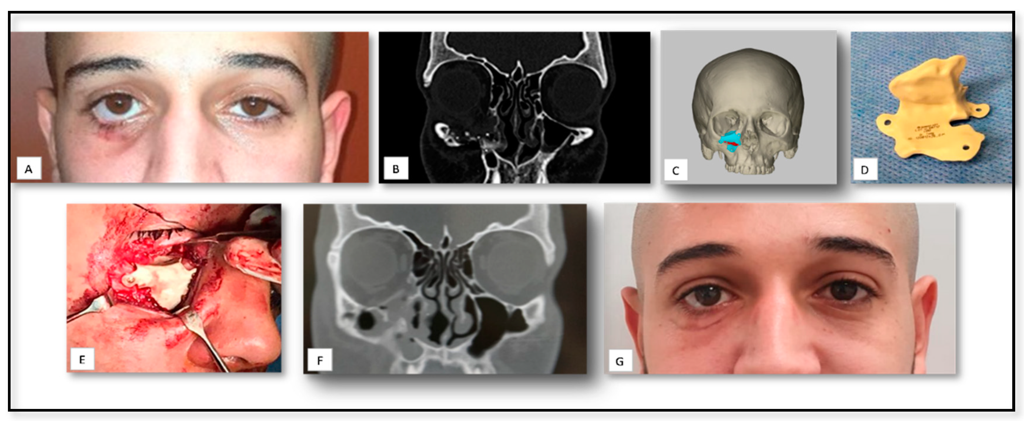 Nanomaterials 10 02523 g004