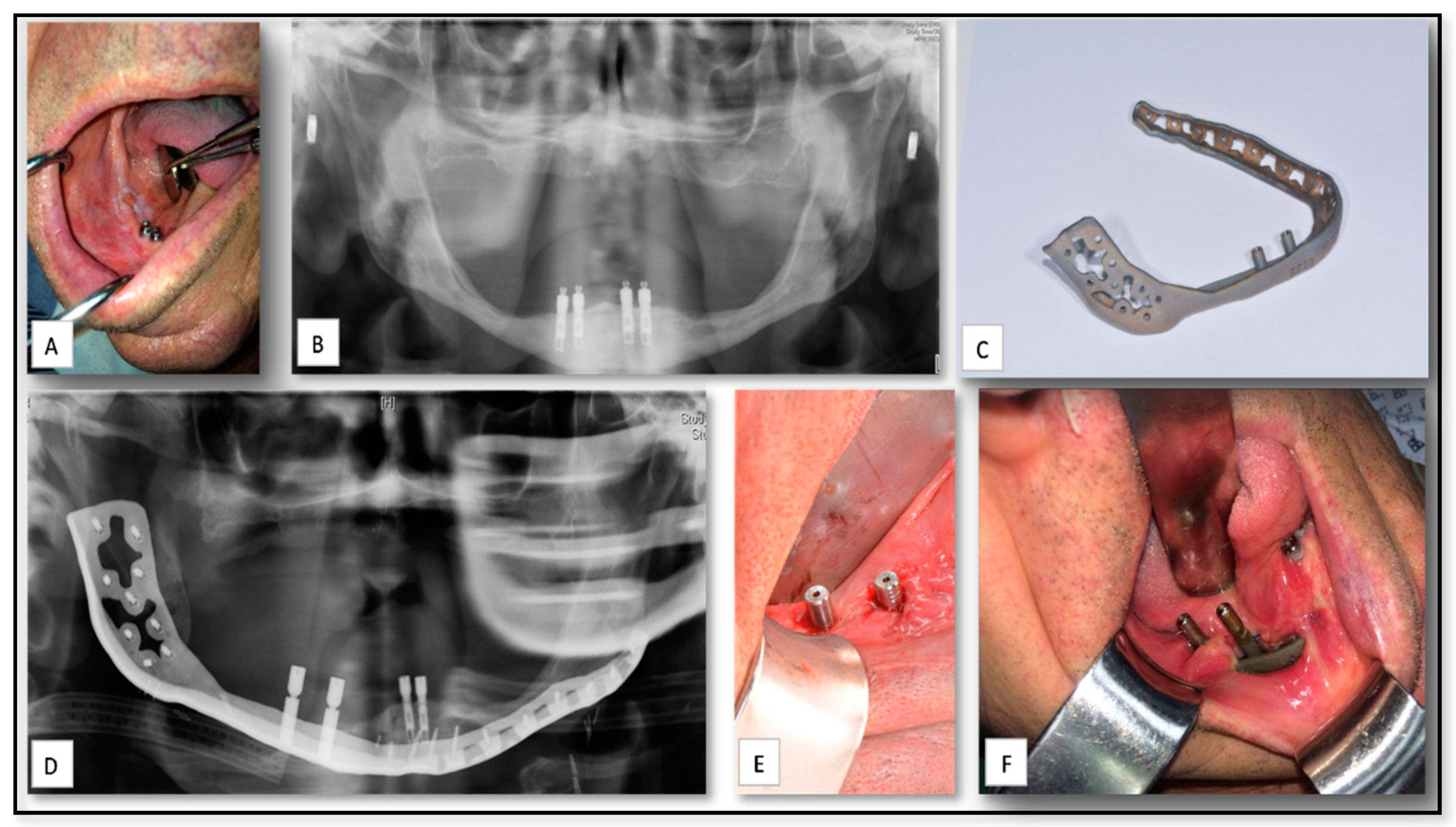 Nanomaterials 10 02523 g006