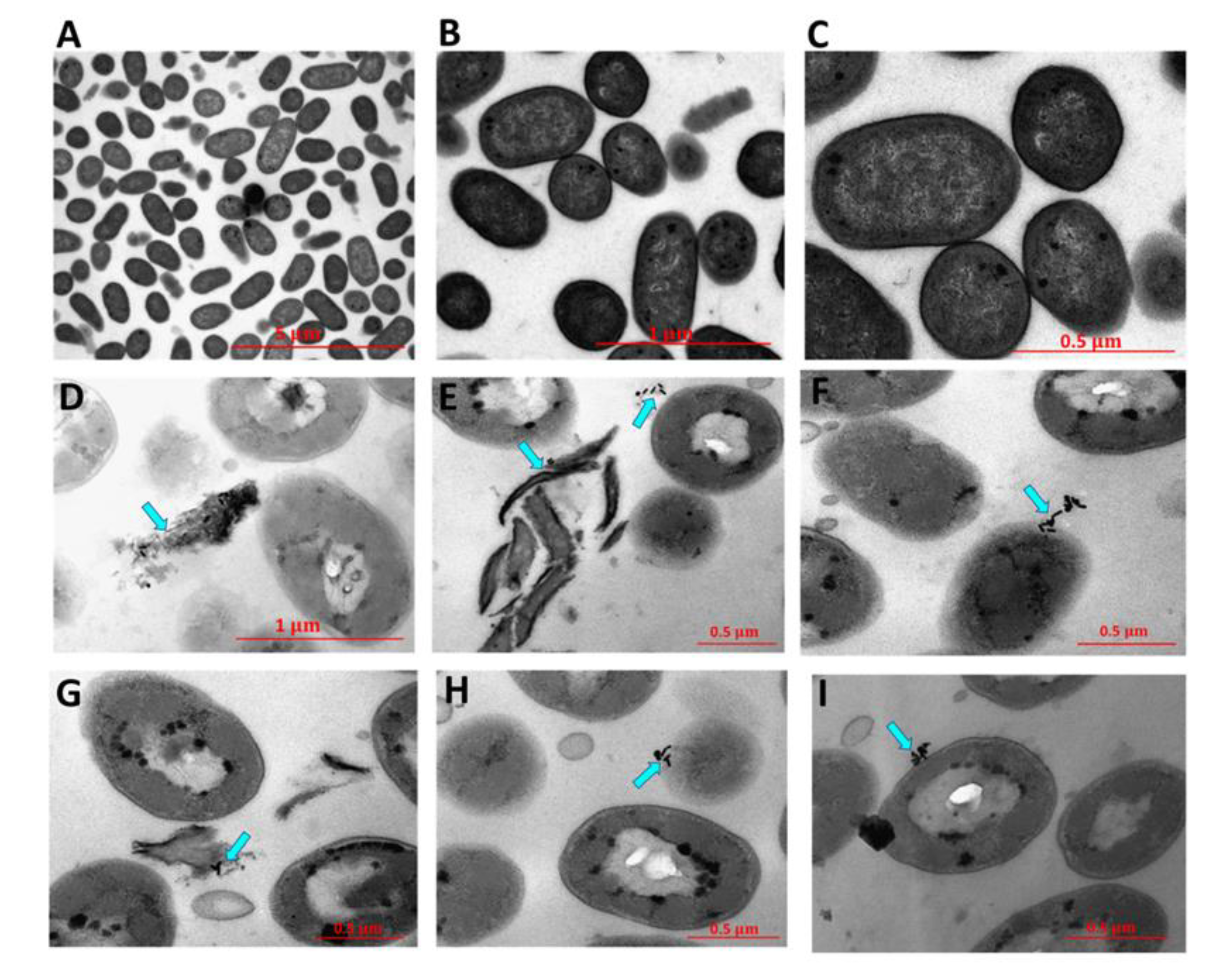 Nanomaterials 11 00312 g004 Nanomaterials 11 00312 g004