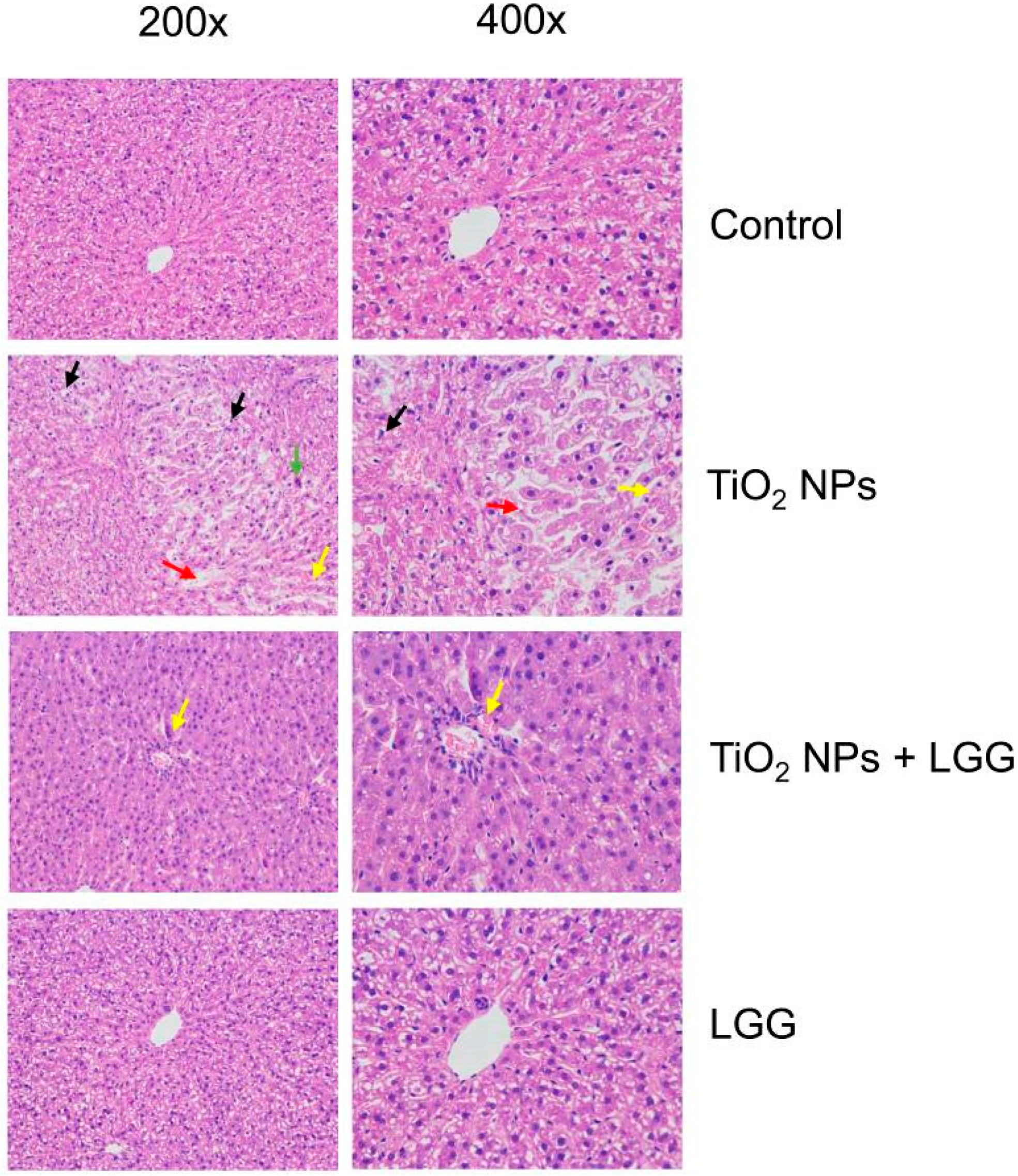 Nanomaterials 11 00803 g006