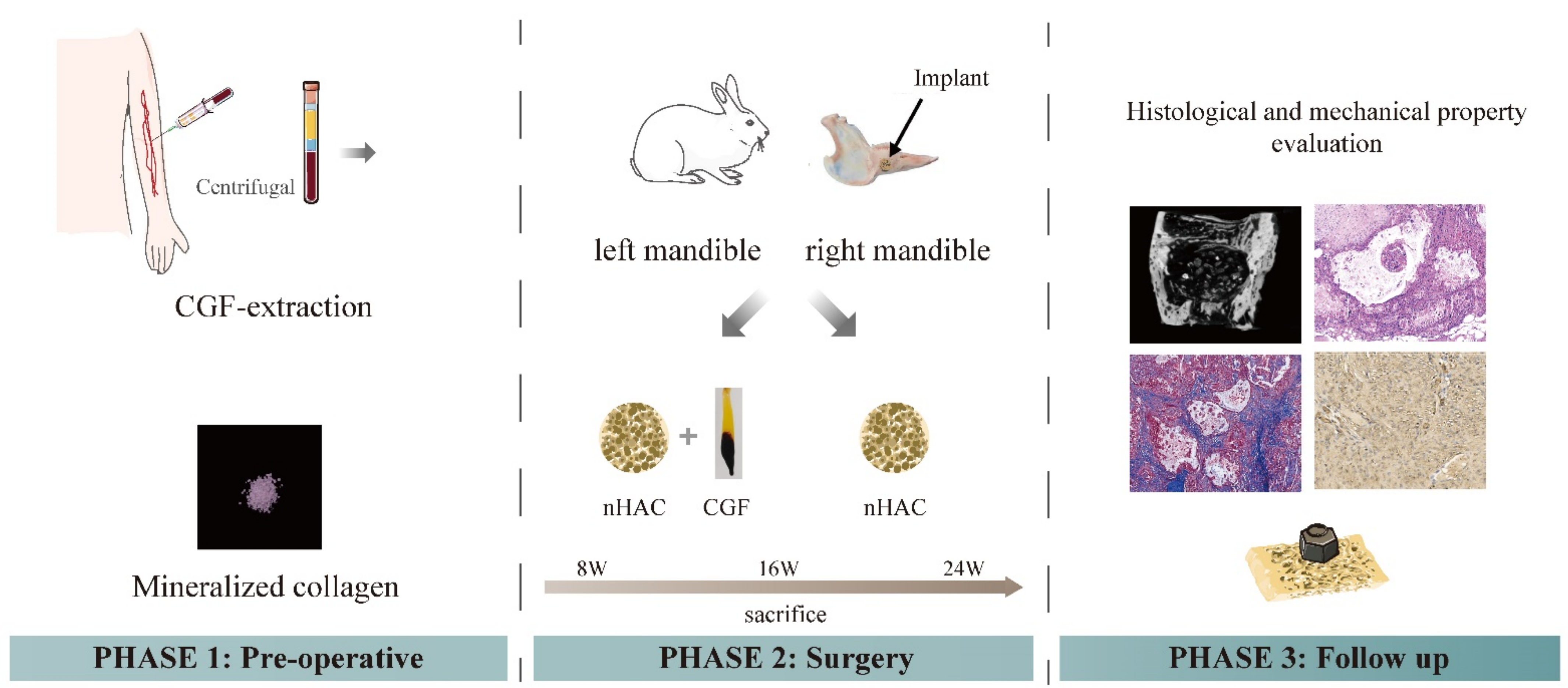 Nanomaterials | Free Full-Text | The Ability and Mechanism of nHAC/CGF in  Promoting Osteogenesis and Repairing Mandibular Defects
